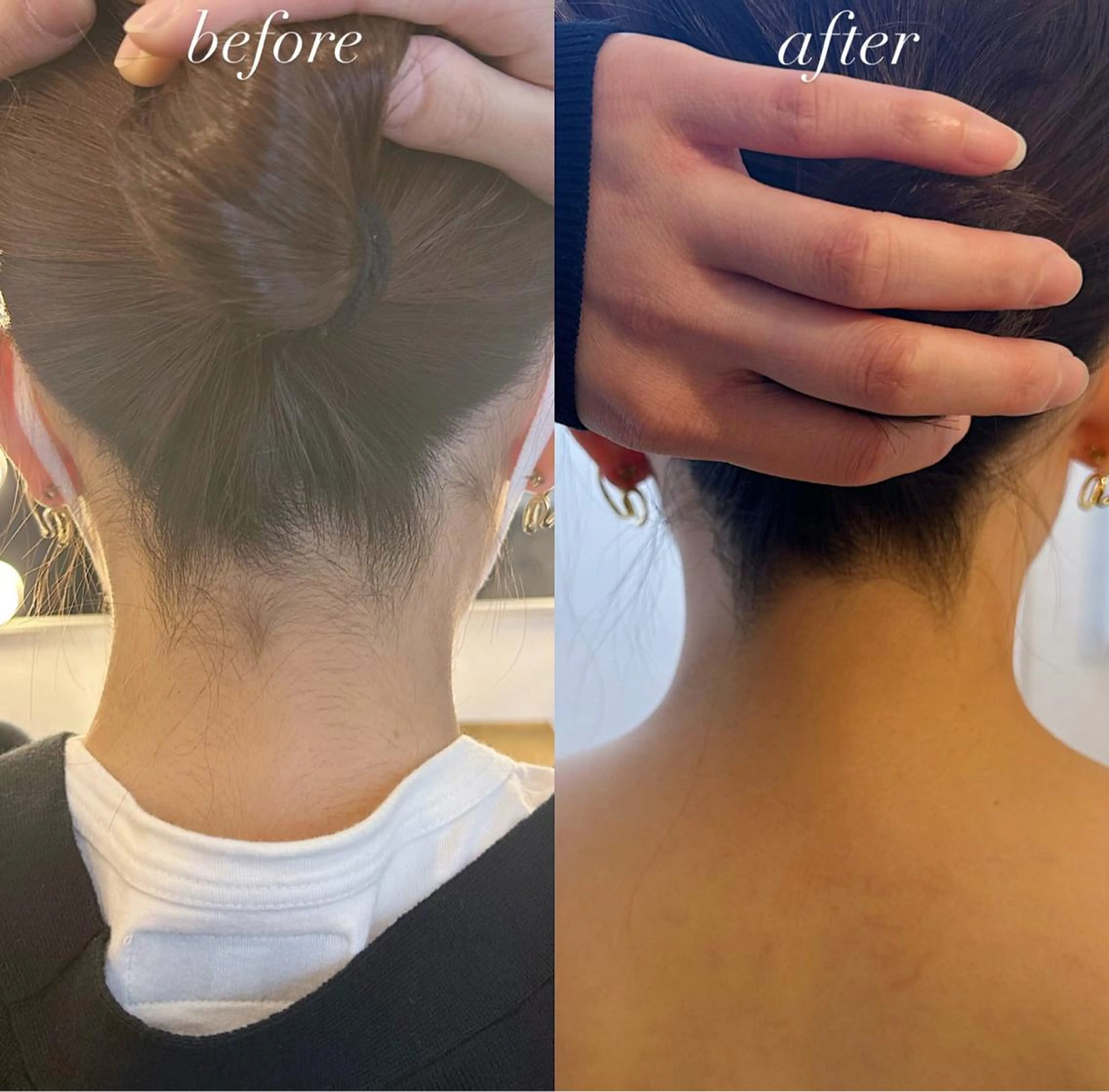 うなじ脱毛/美肌脱毛 LABELのエステ・リラクイメージ