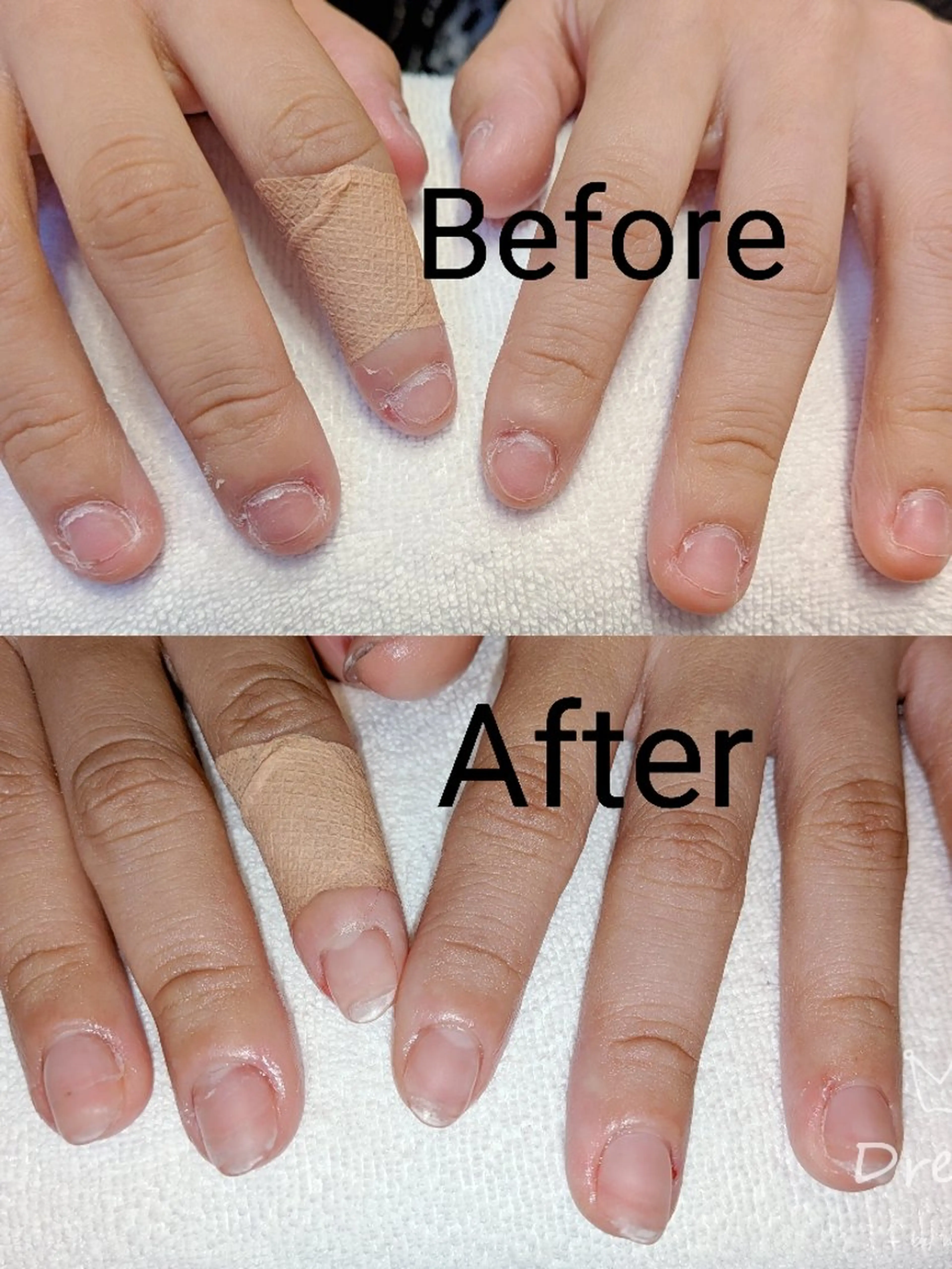 ネイル 長さ出し ハンドネイル ハンドケア ネイリストゆか💅 長さだし、深爪矯正のネイルデザイン