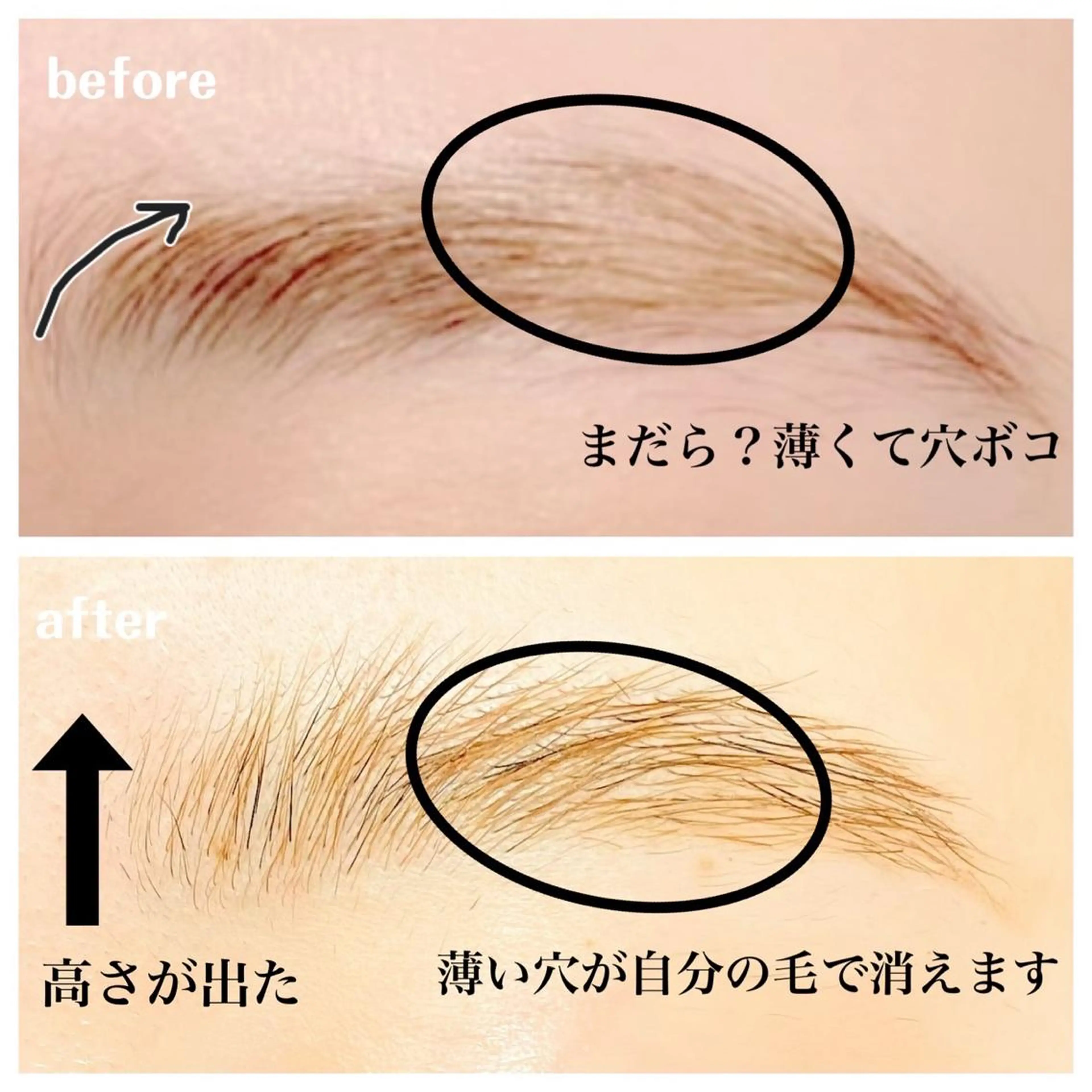 SNSで話題のブロウラミネーション🦋✨眉毛長い方特にオススメ🤍毛流れ改善🌟メイクの時短にも💄の写真