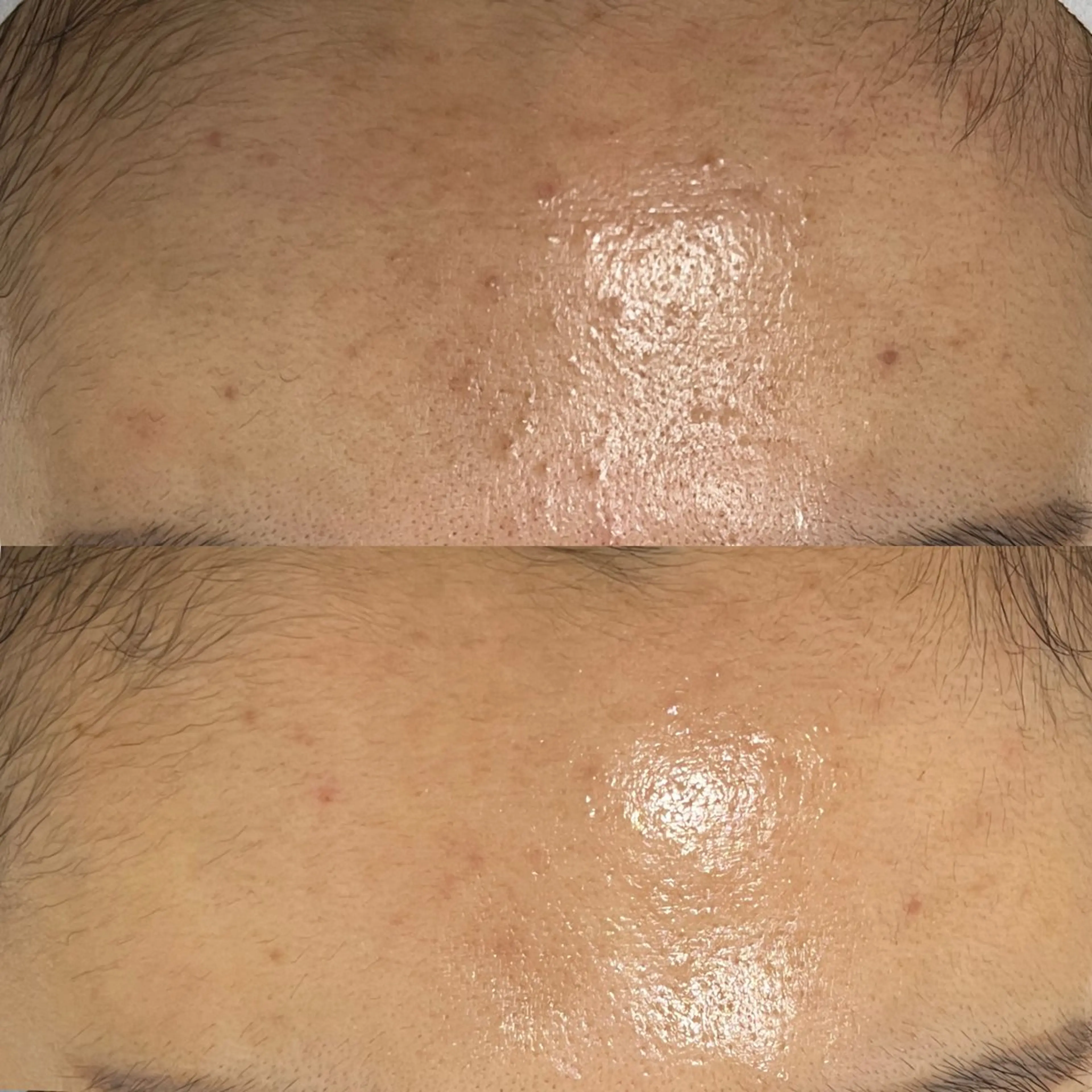 エステ Whitening Beauty 行橋店所属・Whitening Beauty 行橋店のその他イメージ