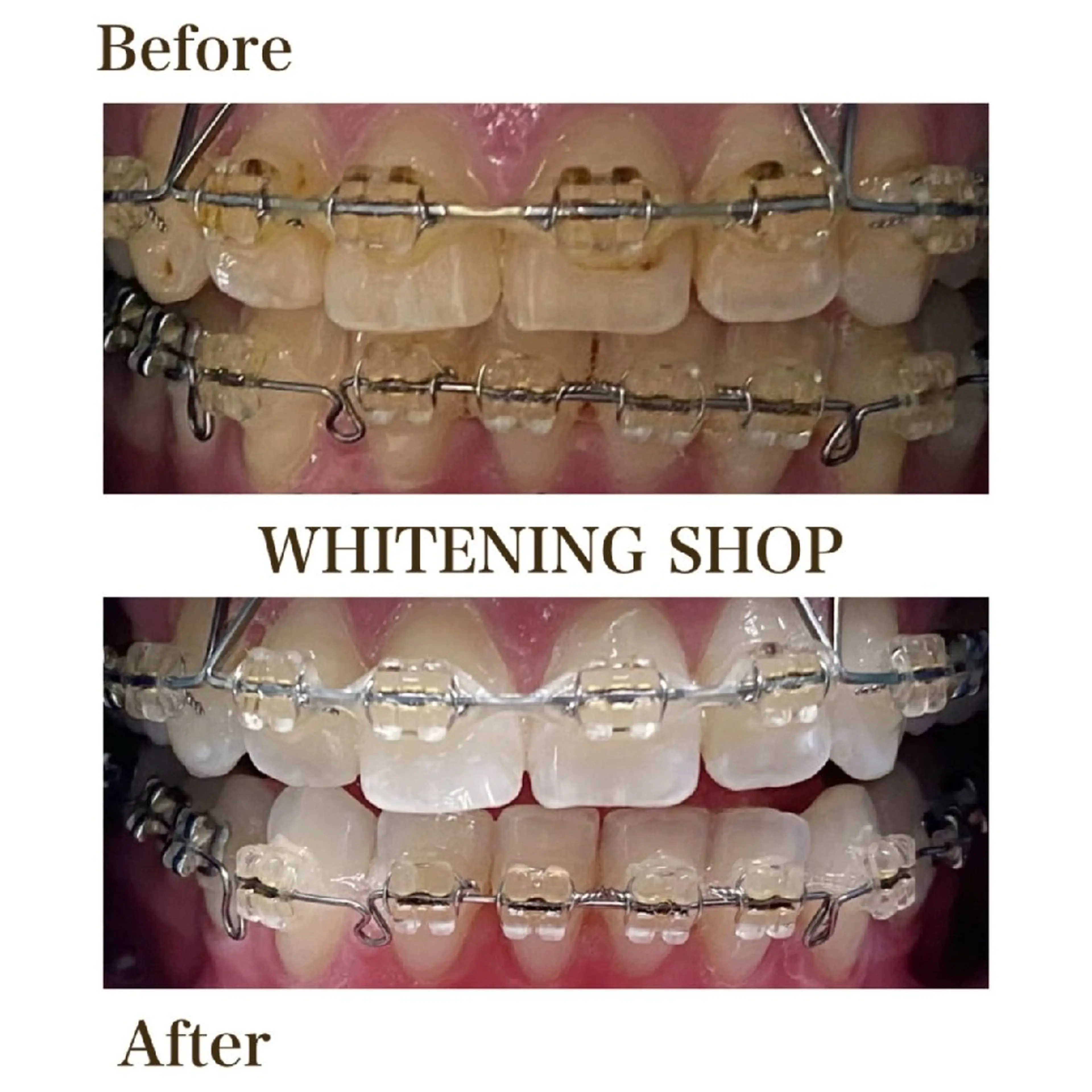 その他 ホワイトニングショップ安城店所属・ホワイトニング ショップ安城店のその他イメージ