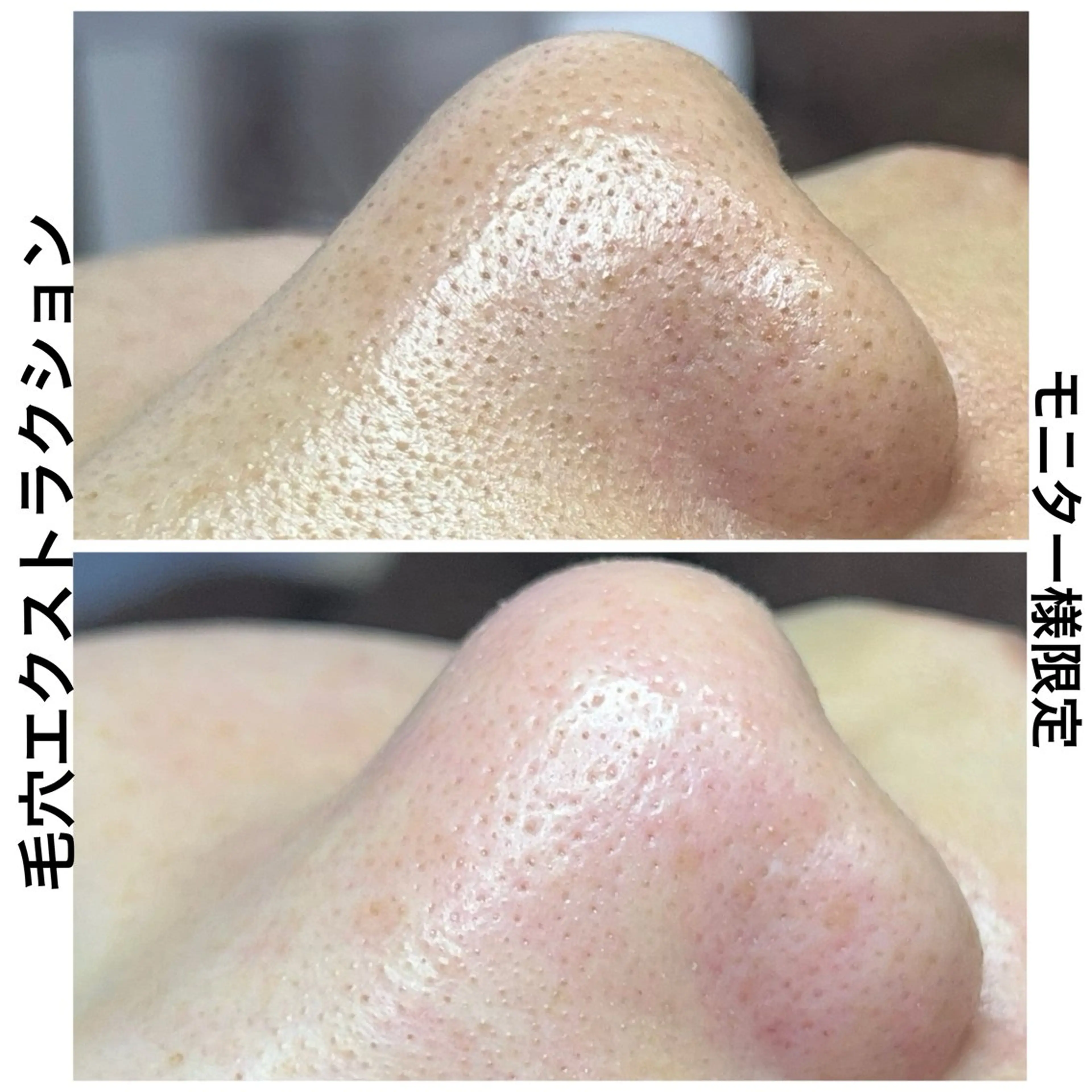 エステ Muqu.所属・Muqu. 毛穴サロンのエステ・リラクイメージ