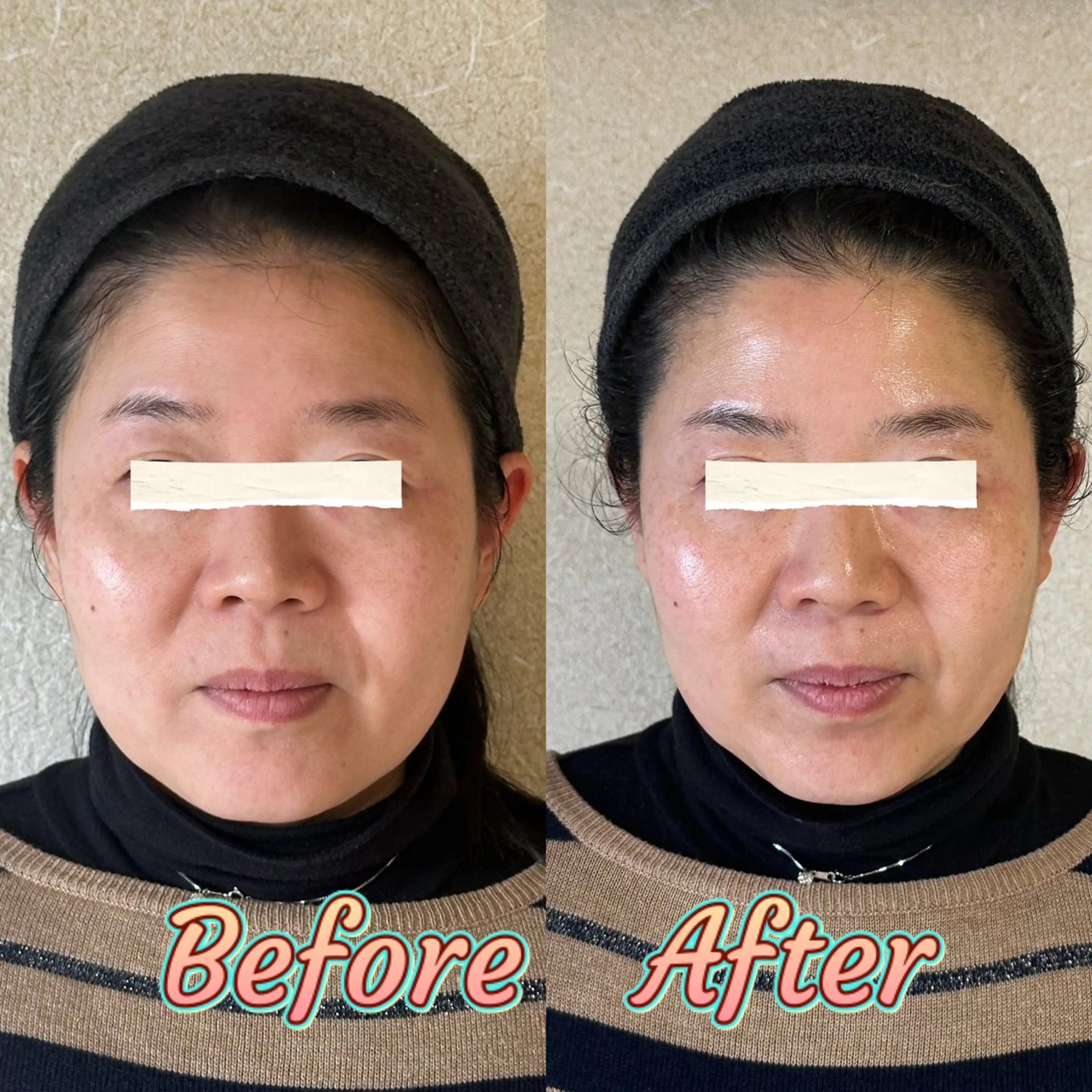 ファーマリジェネ深層美肌コース 50%オフ‼️20000円→10000円の写真