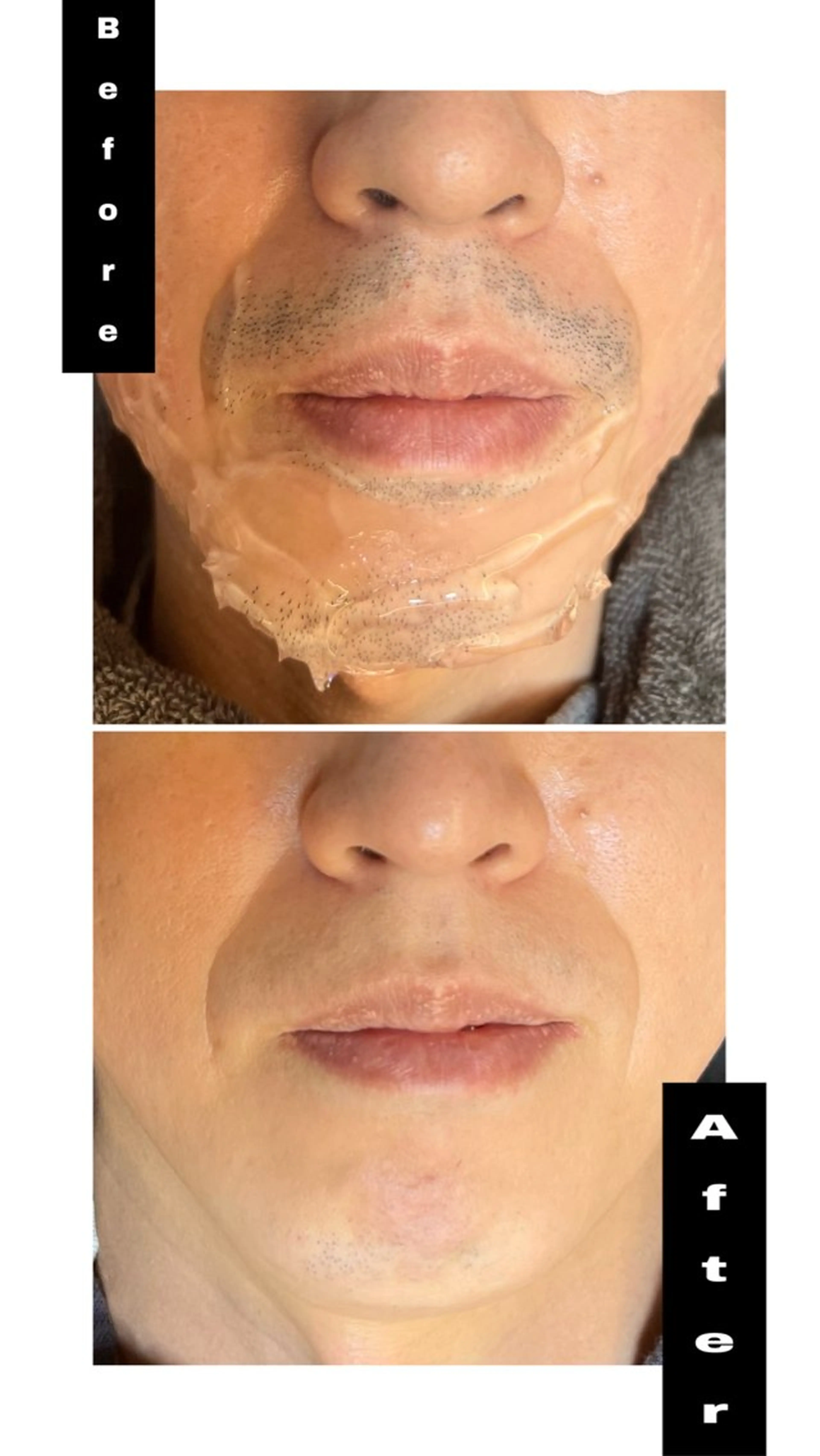 メンズ 脱毛 毛穴洗浄特化🫧 オオツカのエステ・リラクイメージ