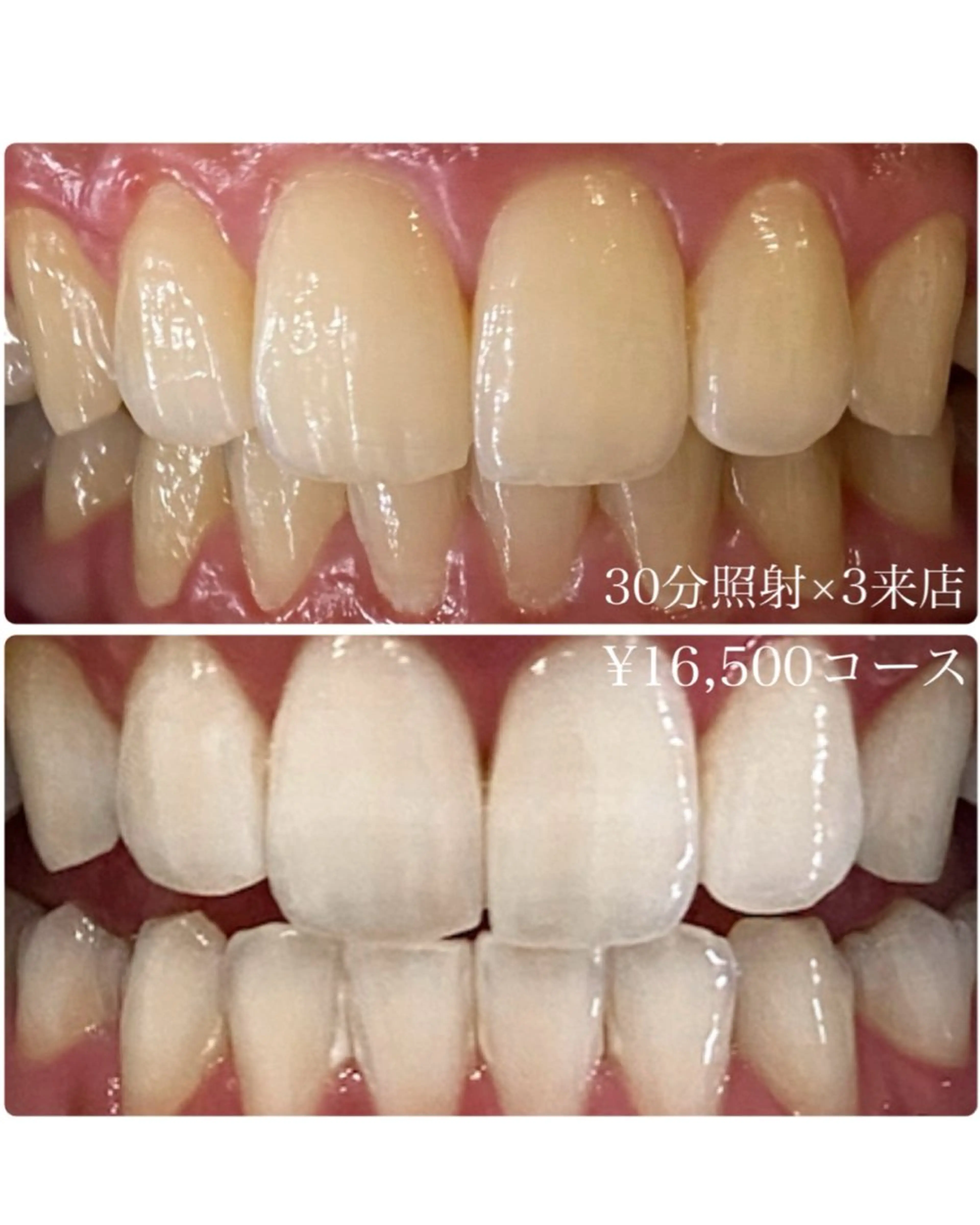 メンズ その他 ホワイトニングルーム　川崎店所属・ホワイトニング ルーム　川崎店のその他イメージ