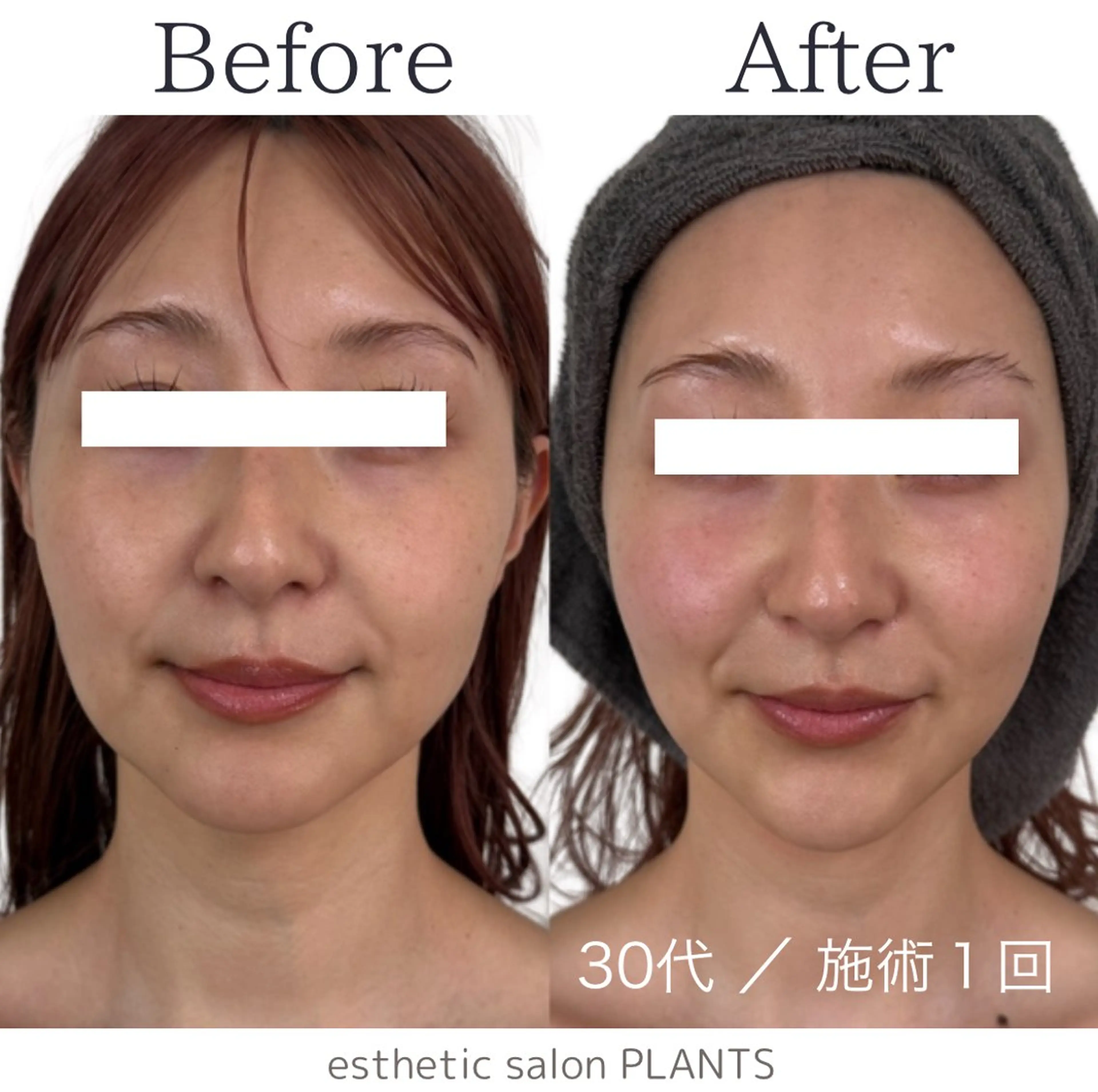 エステ esthetic salon PLANTS所属・エステティックサロン PLANTSのエステ・リラクイメージ