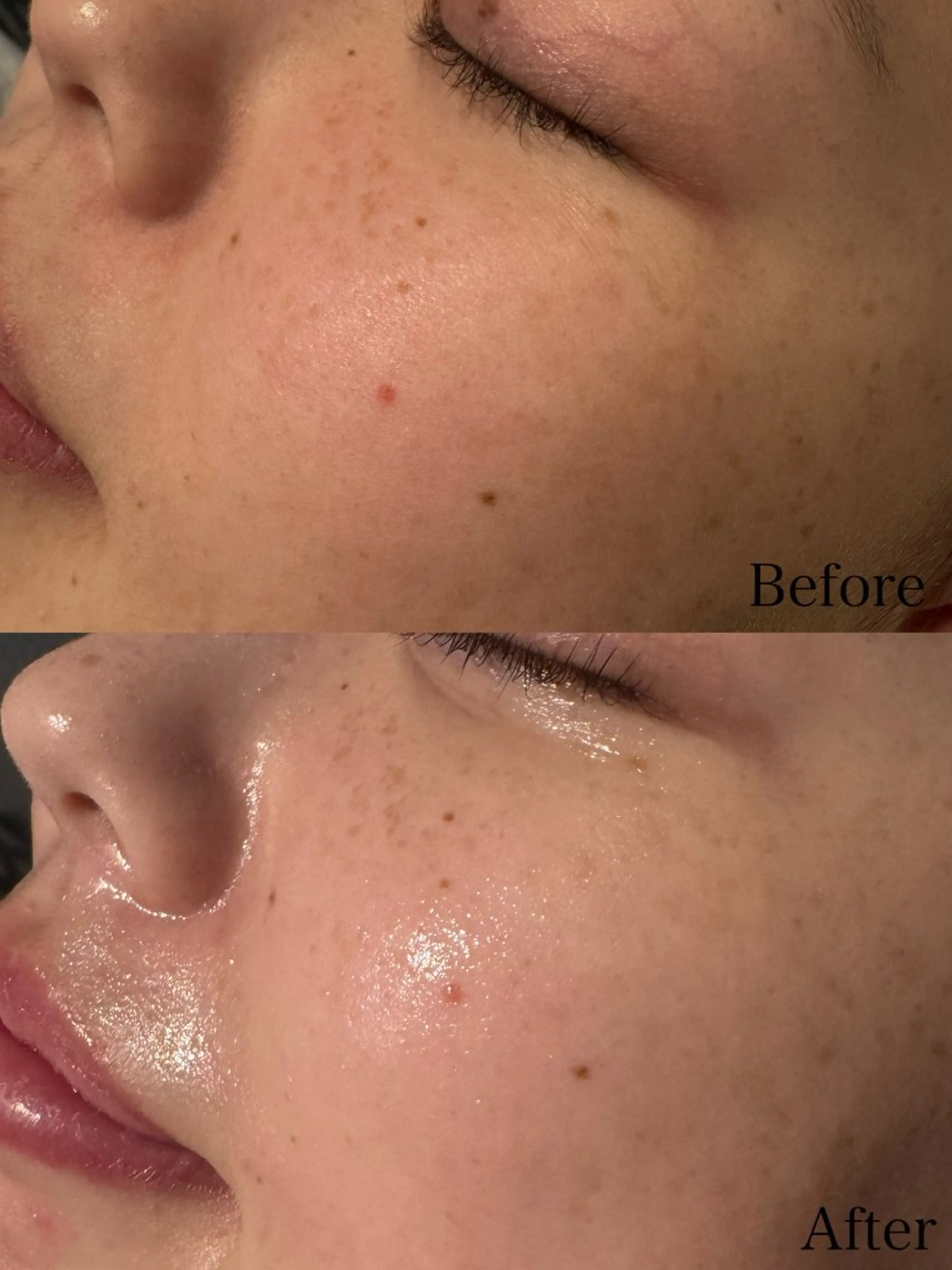 エステ beautysalon LIMOA所属・松本 愛絵理のエステ・リラクイメージ