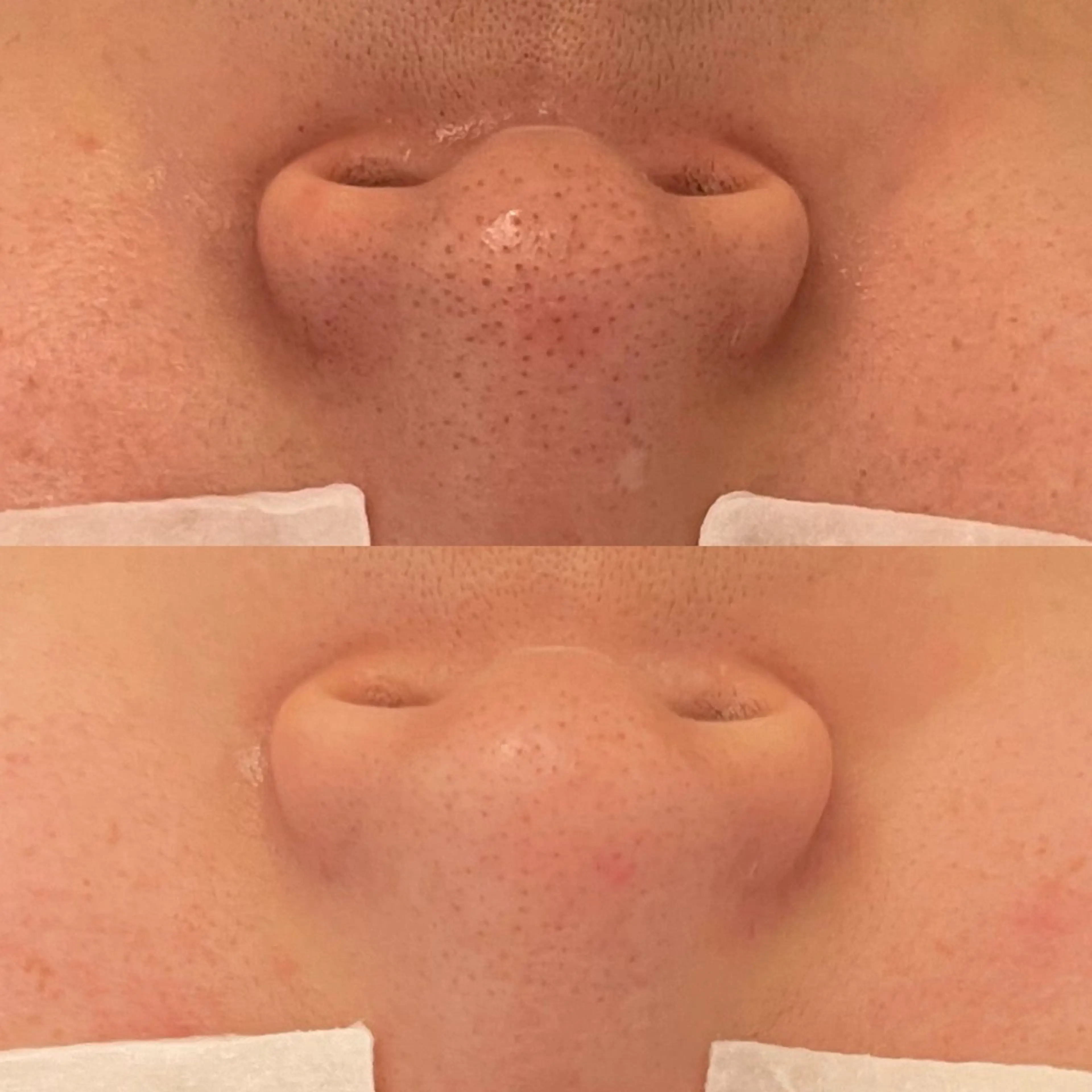 エステ リラク 毛穴ケア/毛穴診断/ 毛穴洗浄〔心斎橋〕のエステ・リラクイメージ