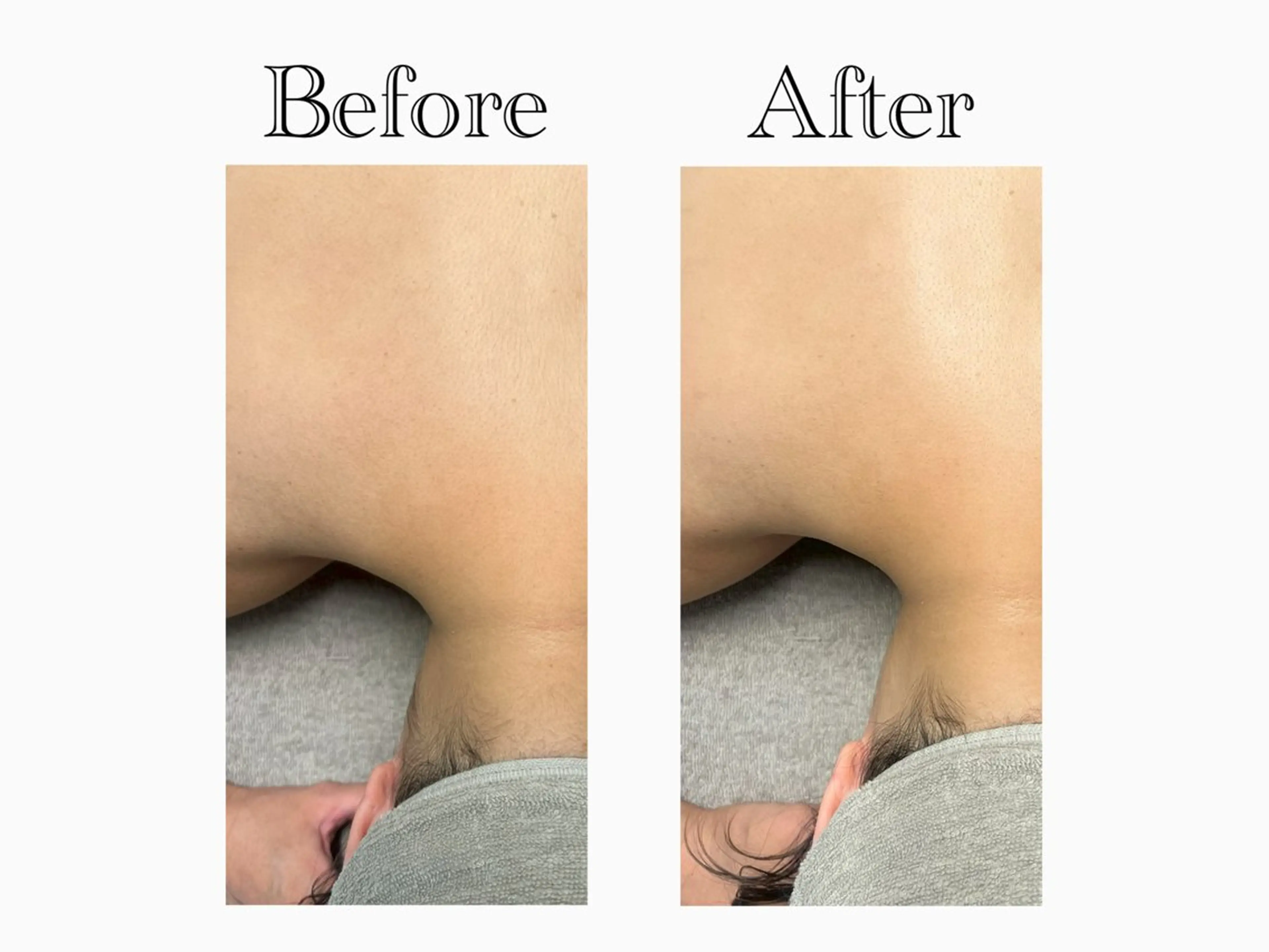 【ブライダル/成人式/撮影】(60分)🌿オールハンドマッサージ💆‍♀️➕顔/背面シェービングで産毛ケア🌙の写真