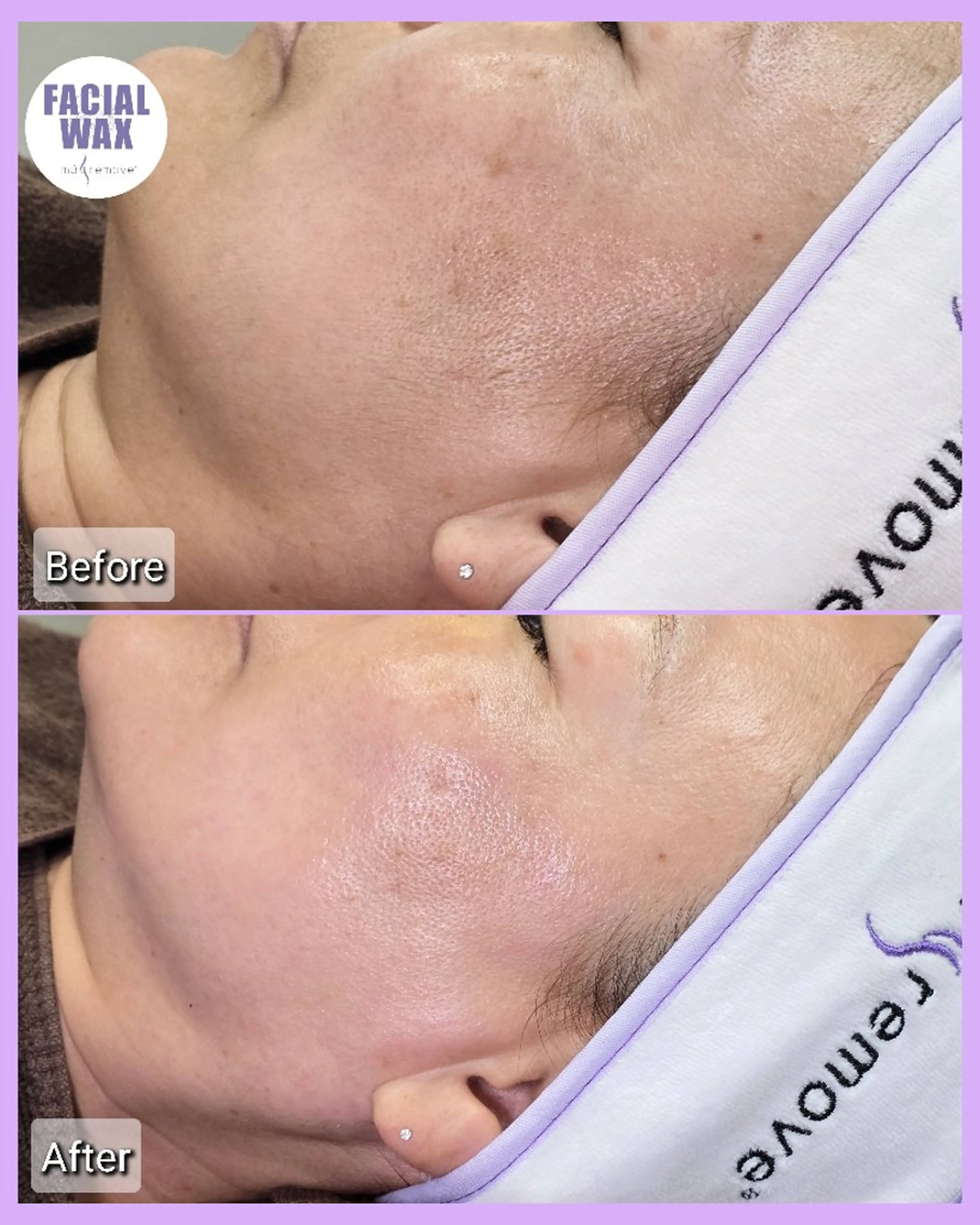 脱毛 facial salon Lily所属・salon Lilyのエステ・リラクイメージ