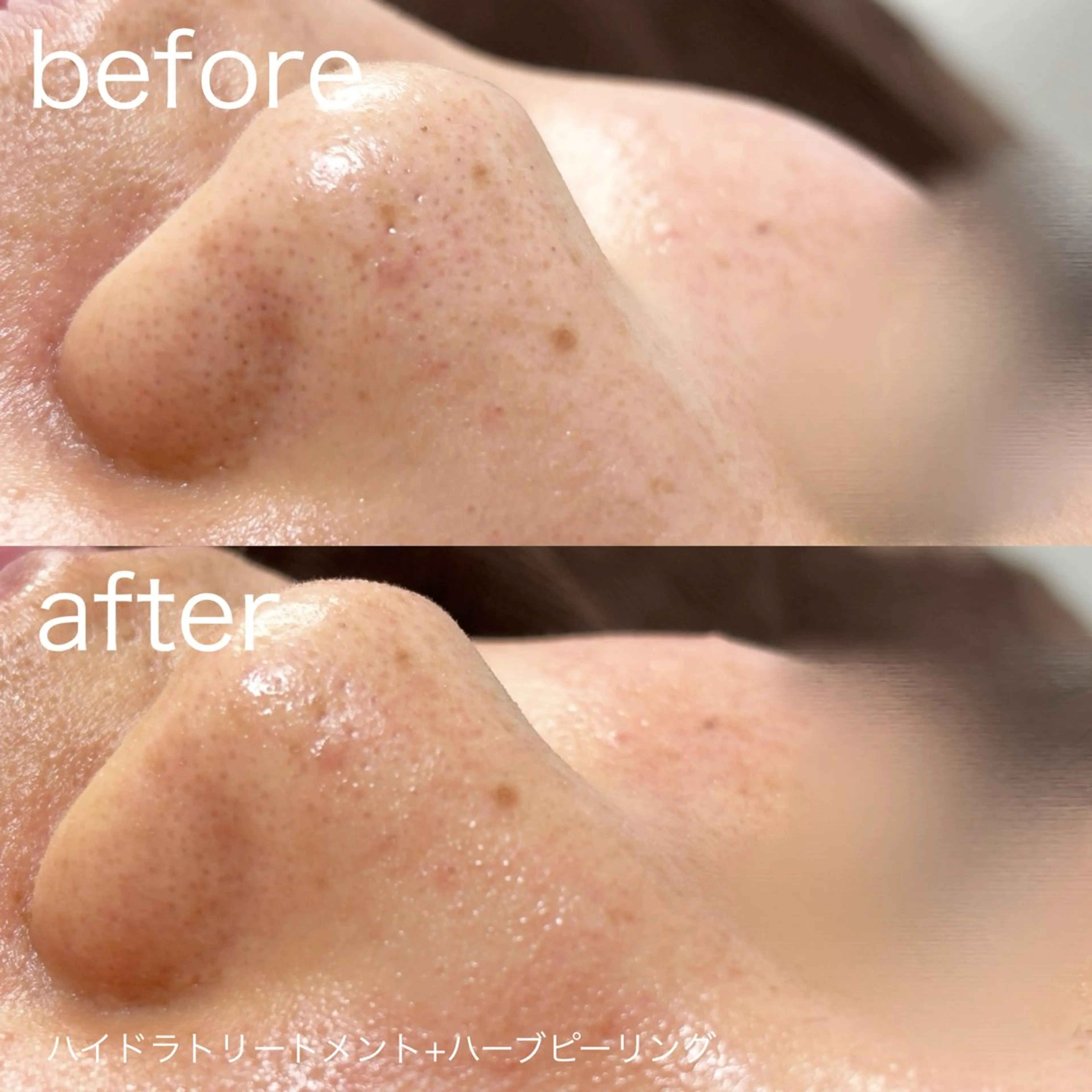 その他 lulularico Yuのエステ・リラクイメージ