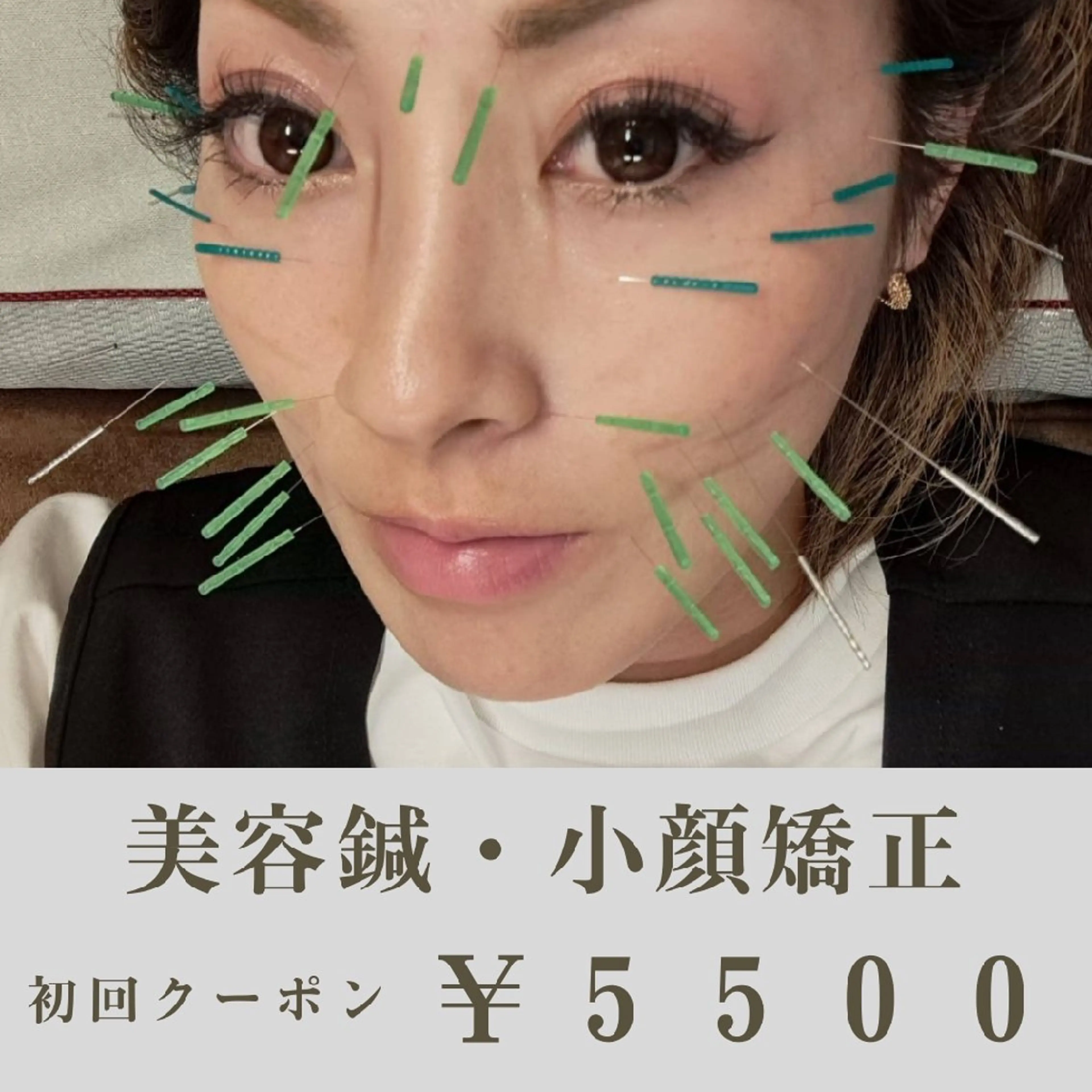 美容鍼・小顔整体　60分の写真