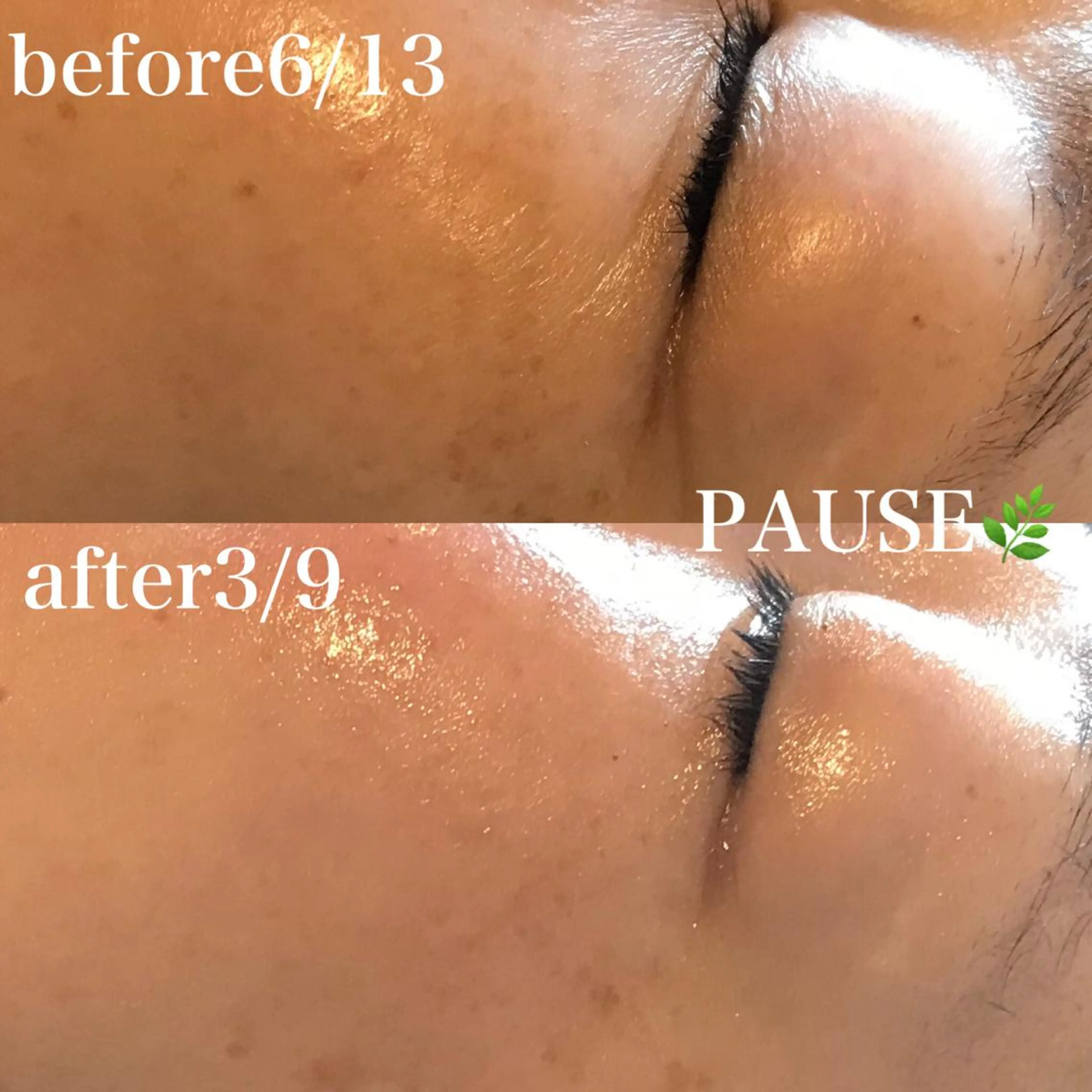 エステ 浜野 恵美のエステ・リラクイメージ