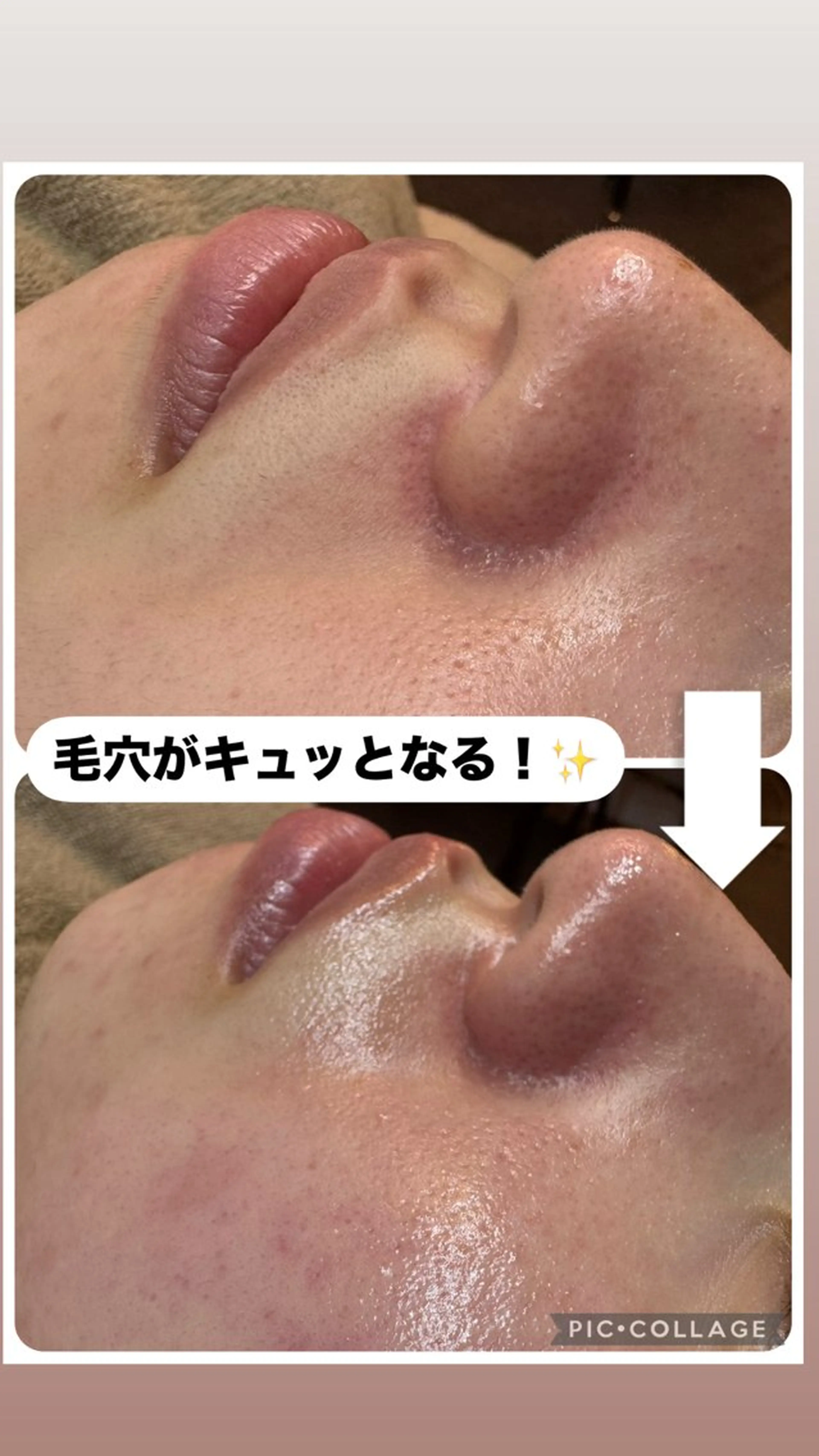 W MISATOのエステ・リラクイメージ