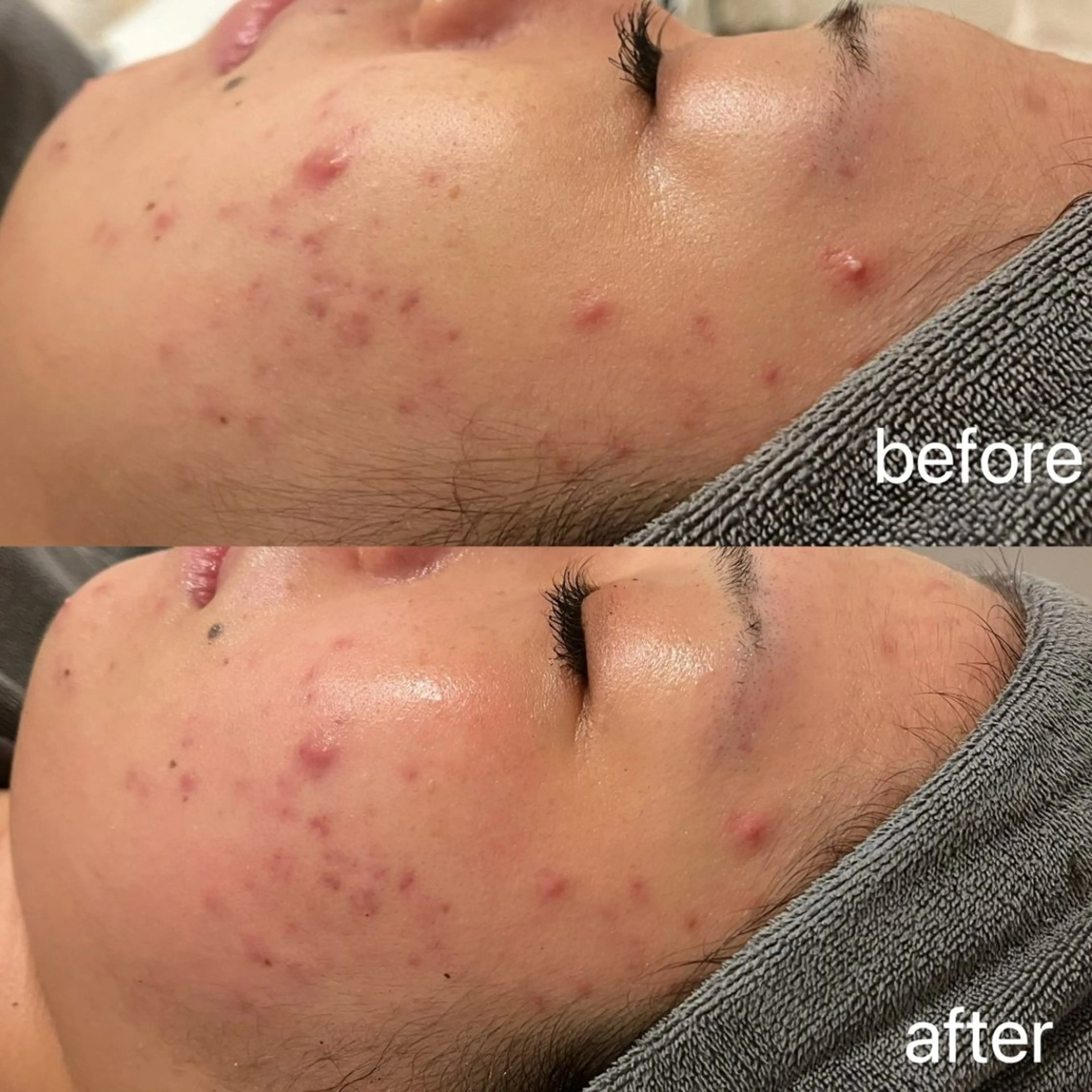 エステ 小顔＆まつ毛サロン AKANE❤️のエステ・リラクイメージ