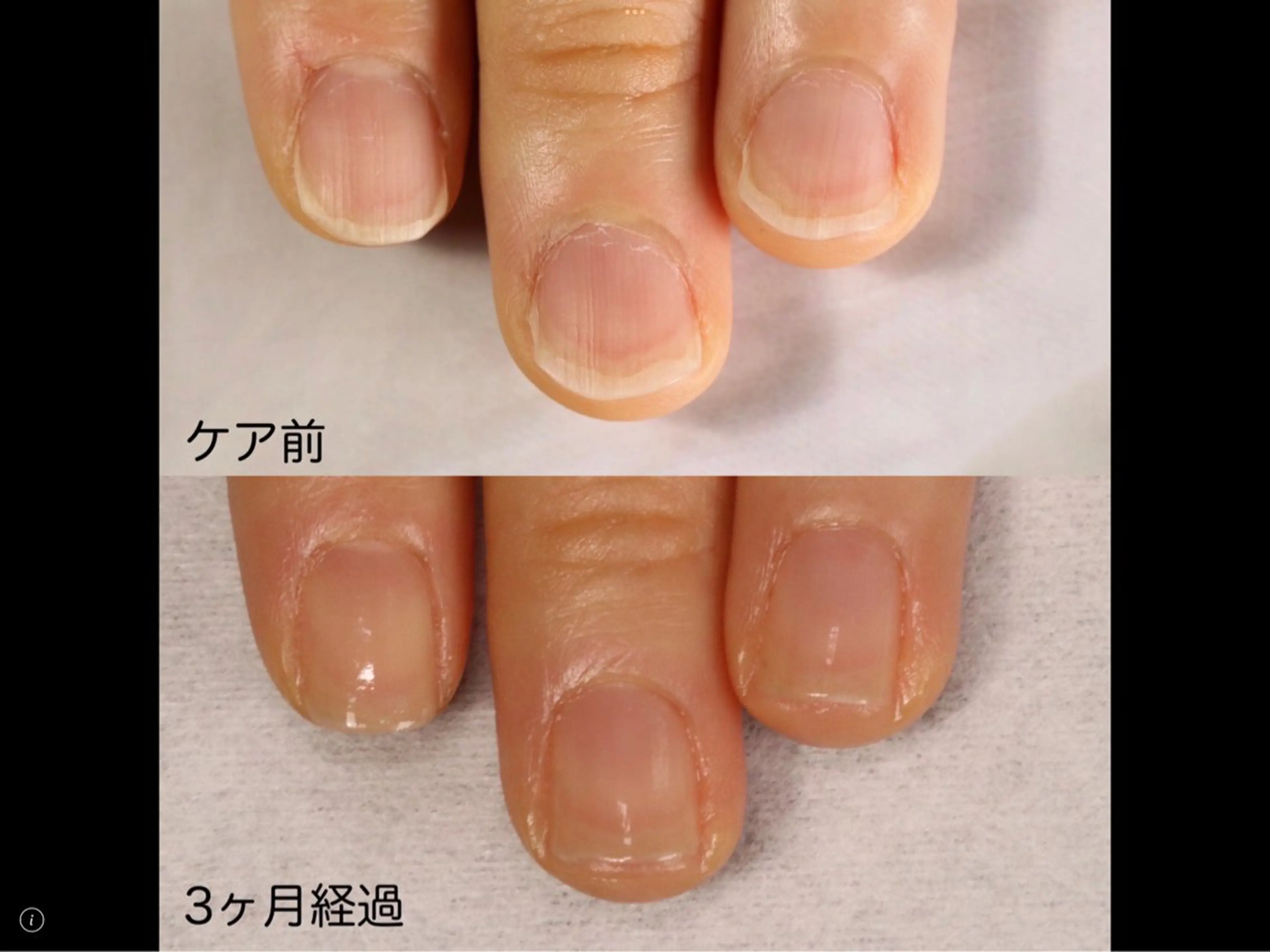 ネイル ハンドケア プライベートサロン jewel nailのネイルデザイン