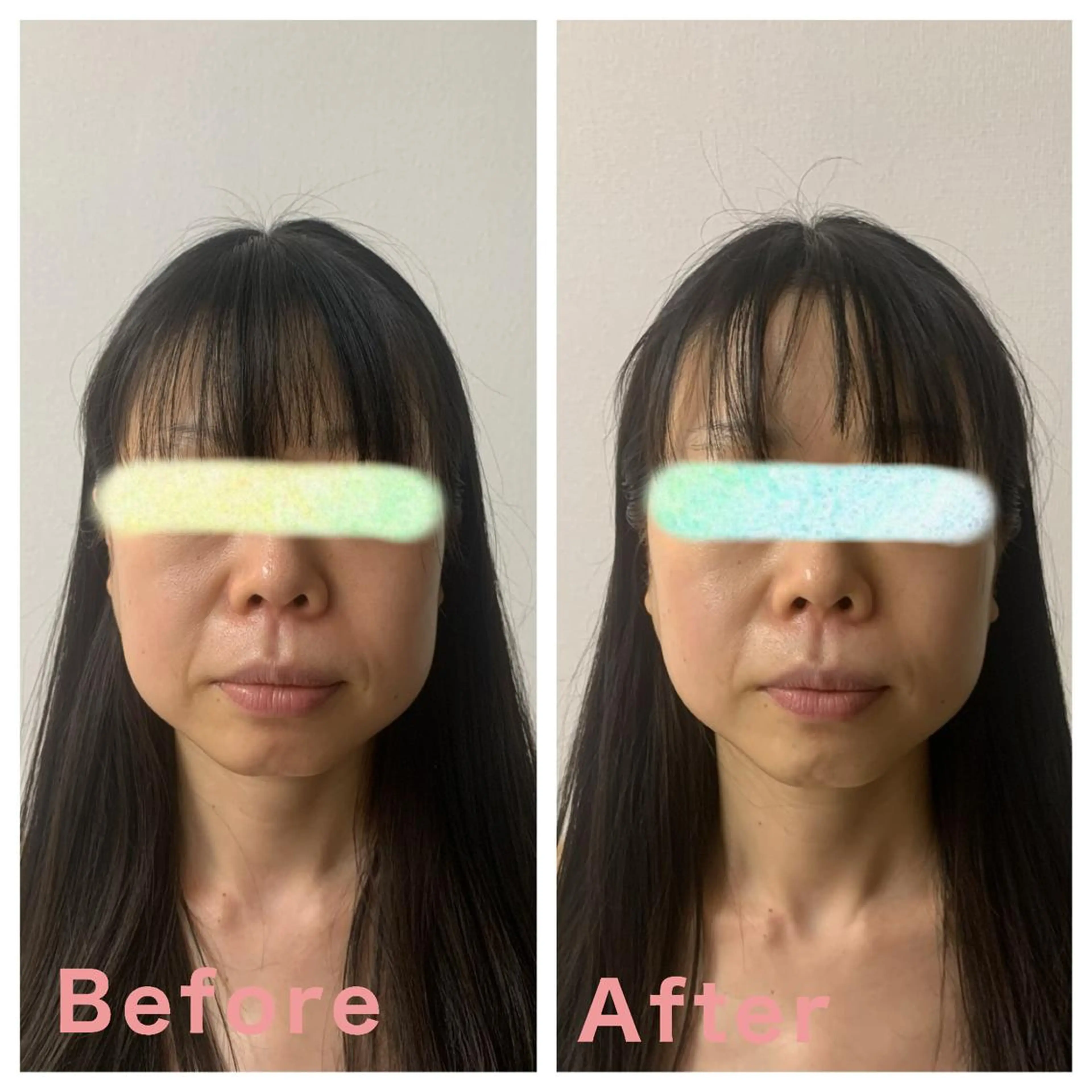 ボディ&フェイシャルサロン Vierouge所属・肌質改善・美肌サロン ヴィエルージュのエステ・リラクイメージ