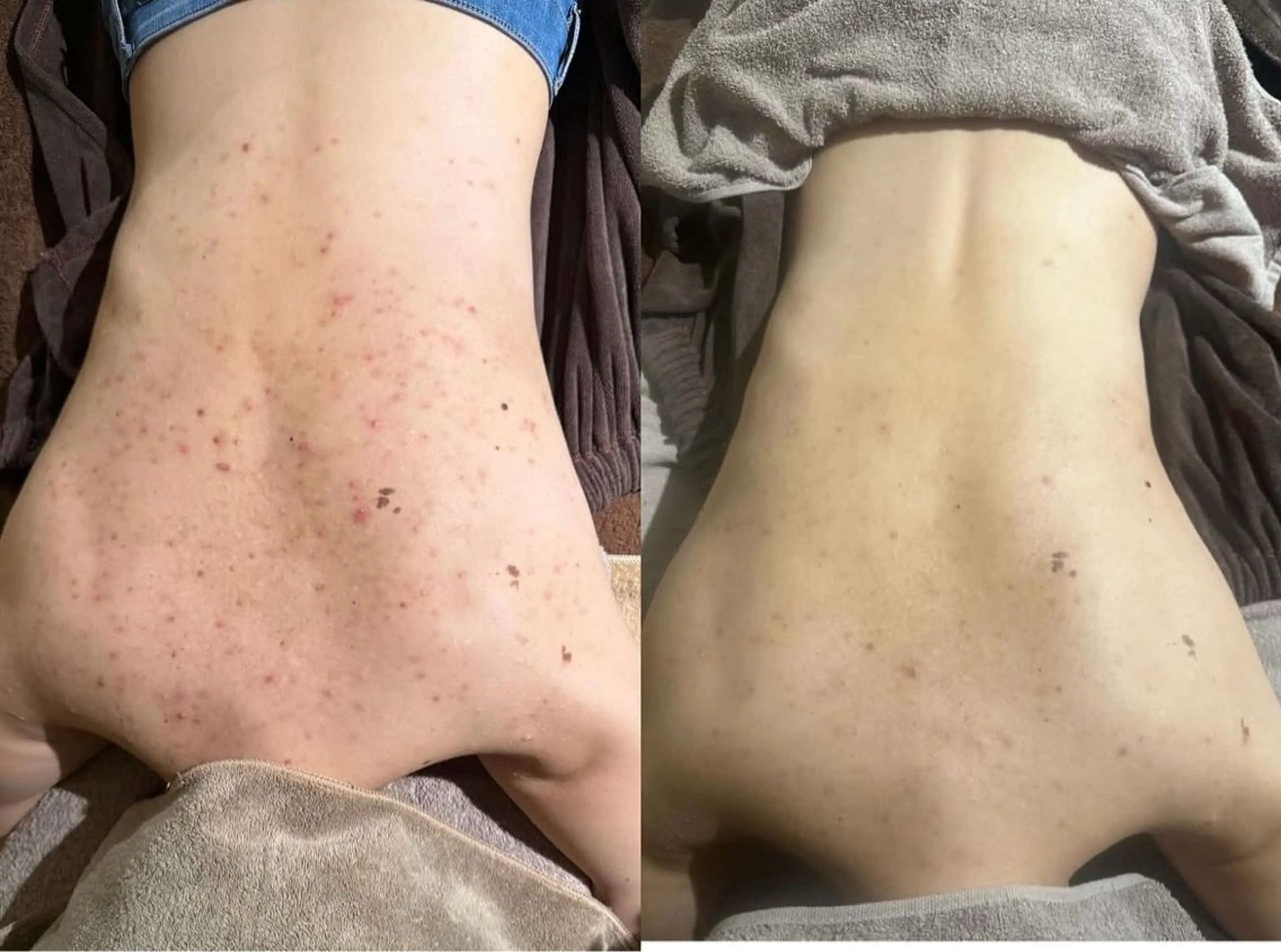 エミルカ 自由が丘店所属・花島 悠のエステ・リラクイメージ