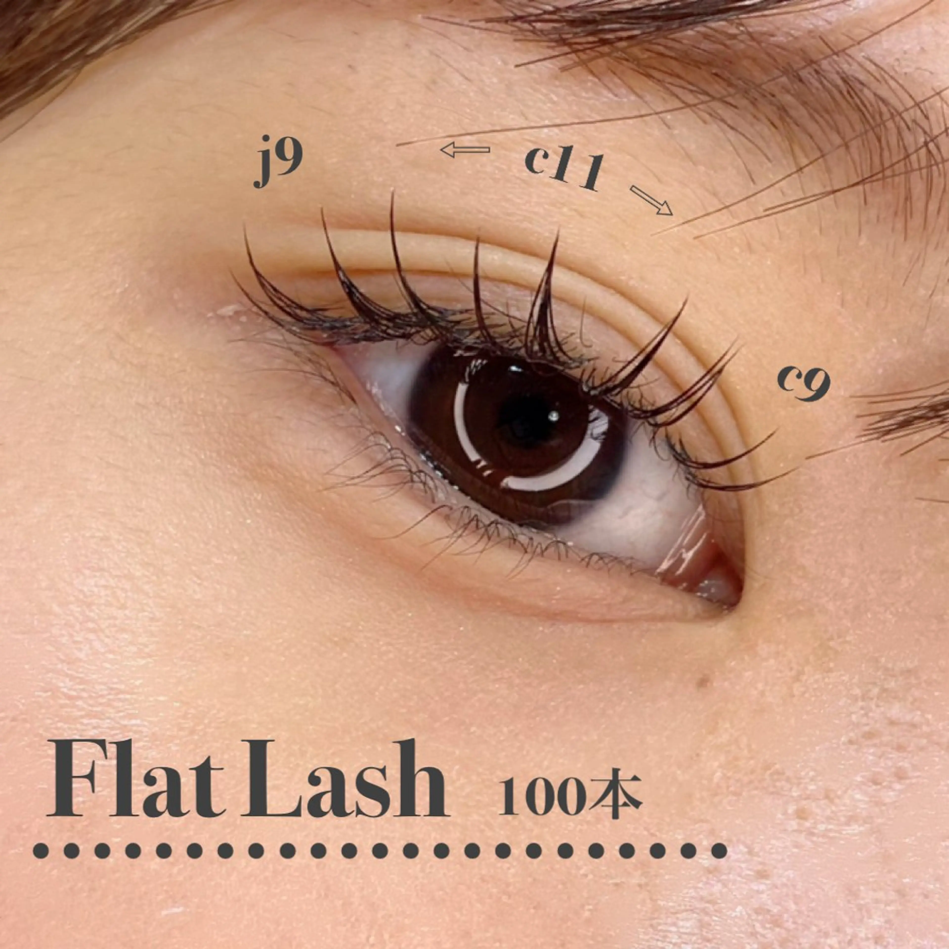 【フラットラッシュ】　100本の写真