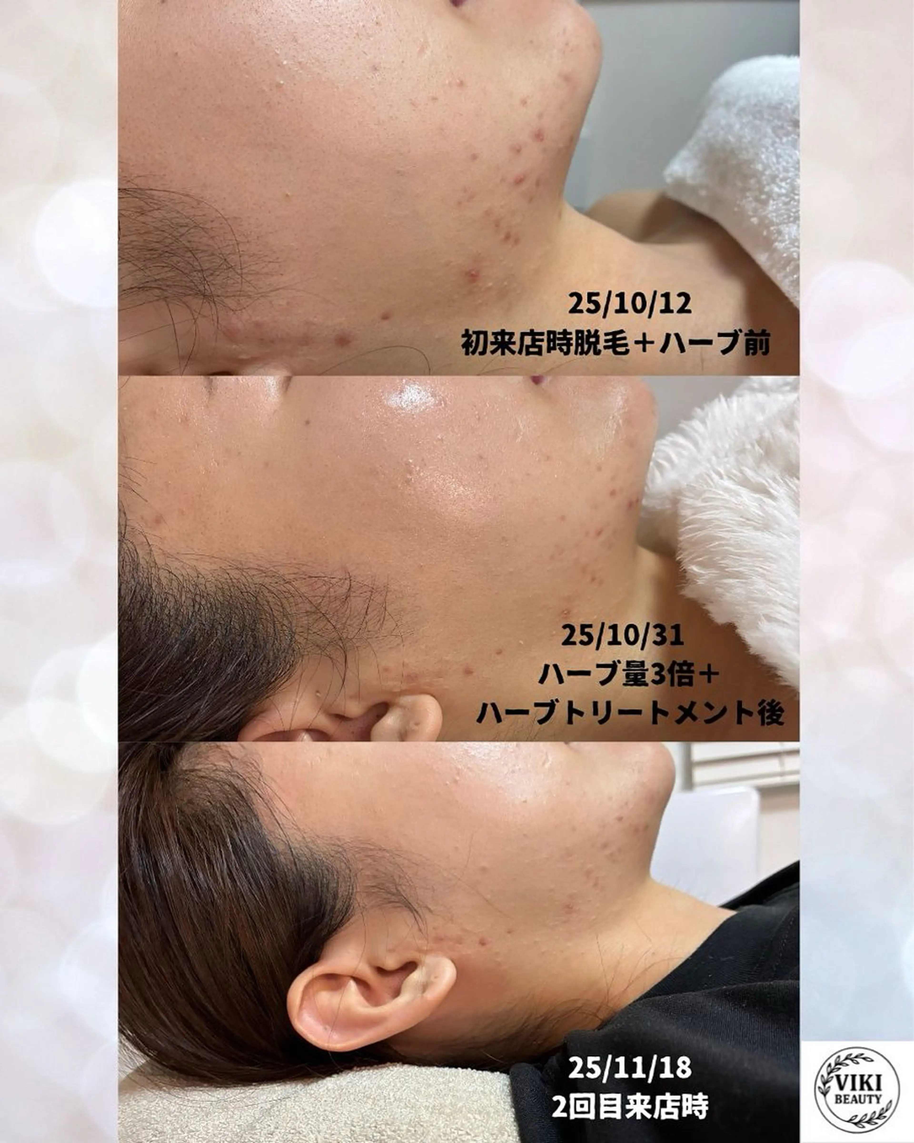 VIKI BEAUTY  クレイハーブピーリング・美肌脱毛専門店所属・VIKI BEAUTYのエステ・リラクイメージ