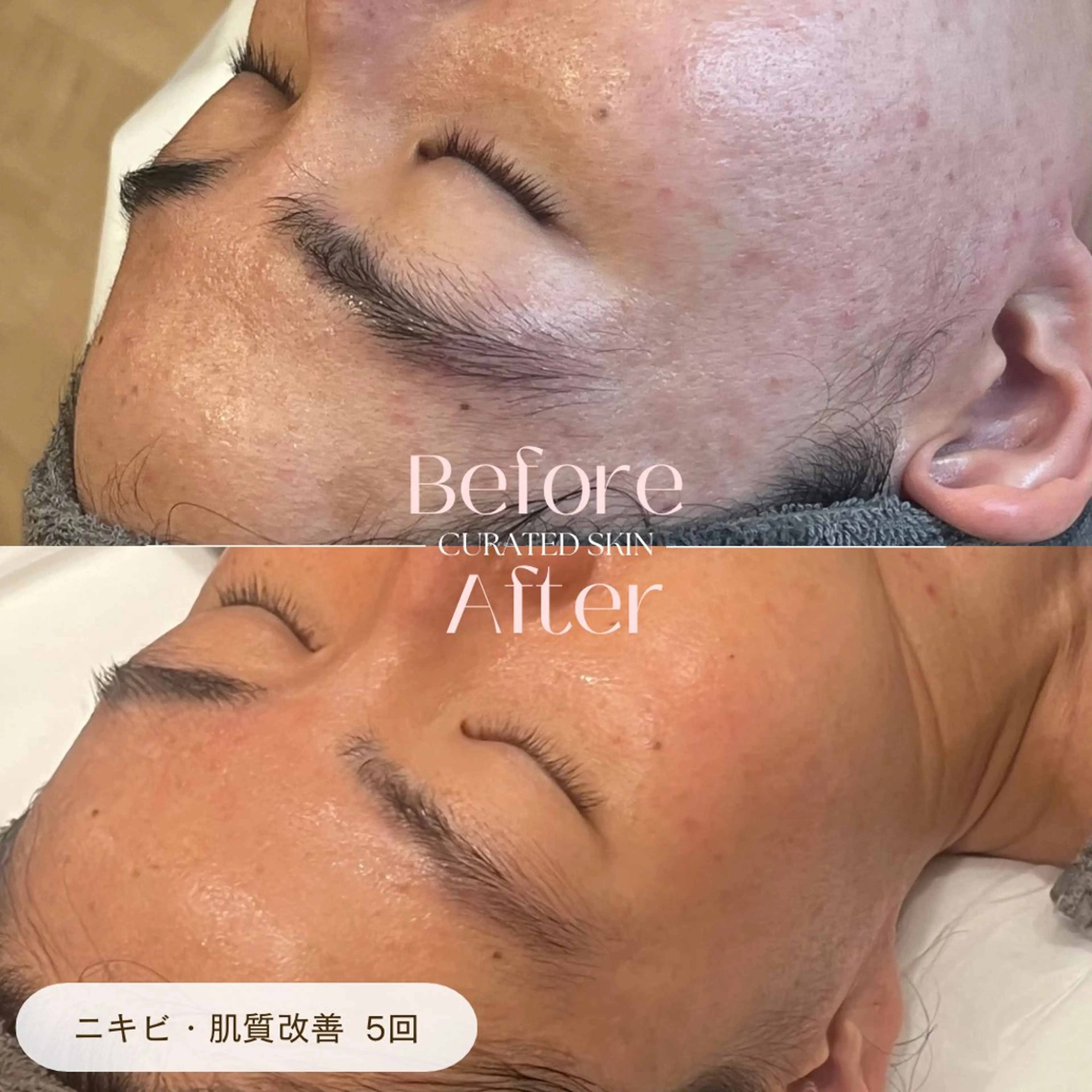 CURATED SKINのエステ・リラクイメージ