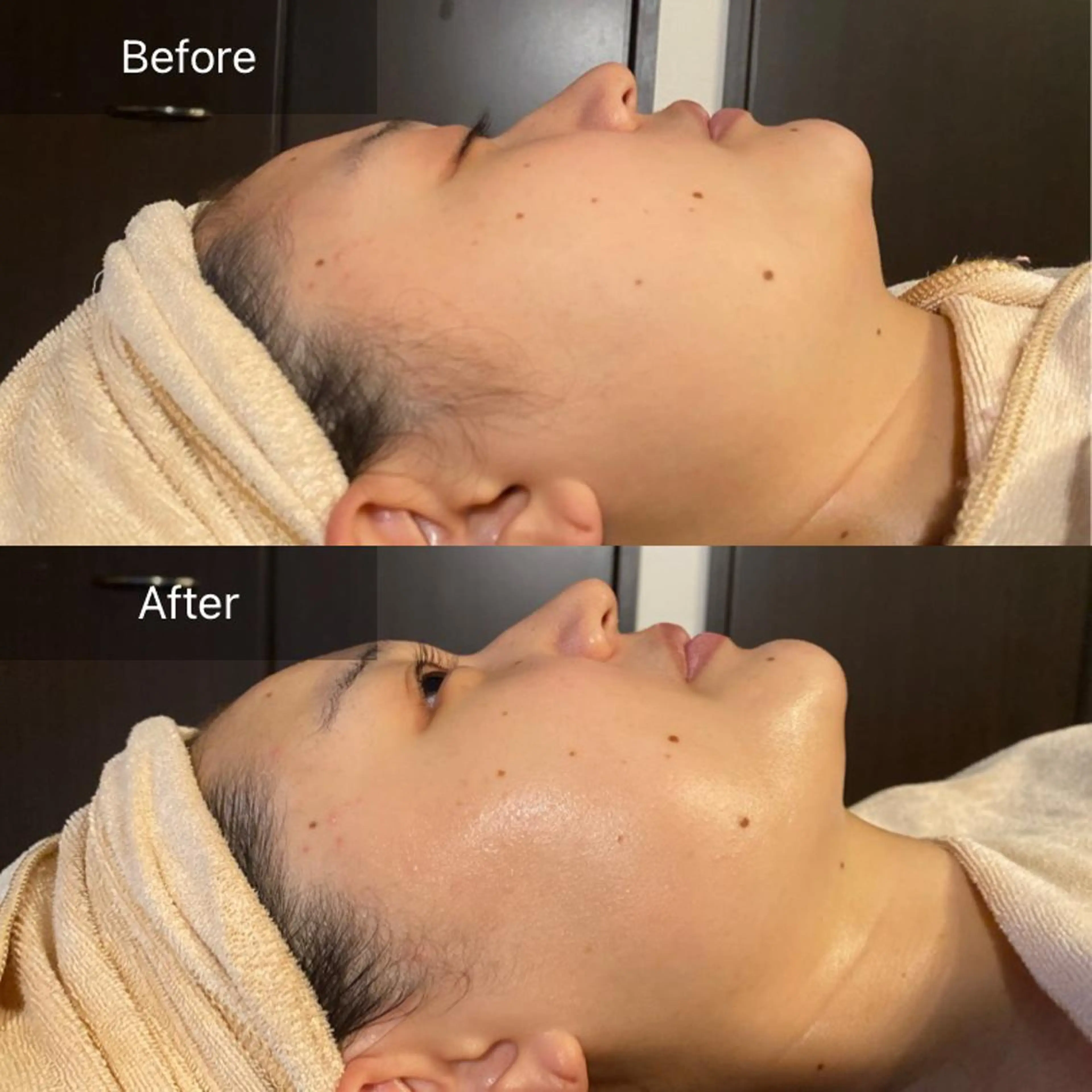 Mandarin Orange所属・毛穴から始める肌メン テマンダリンオレンジのエステ・リラクイメージ