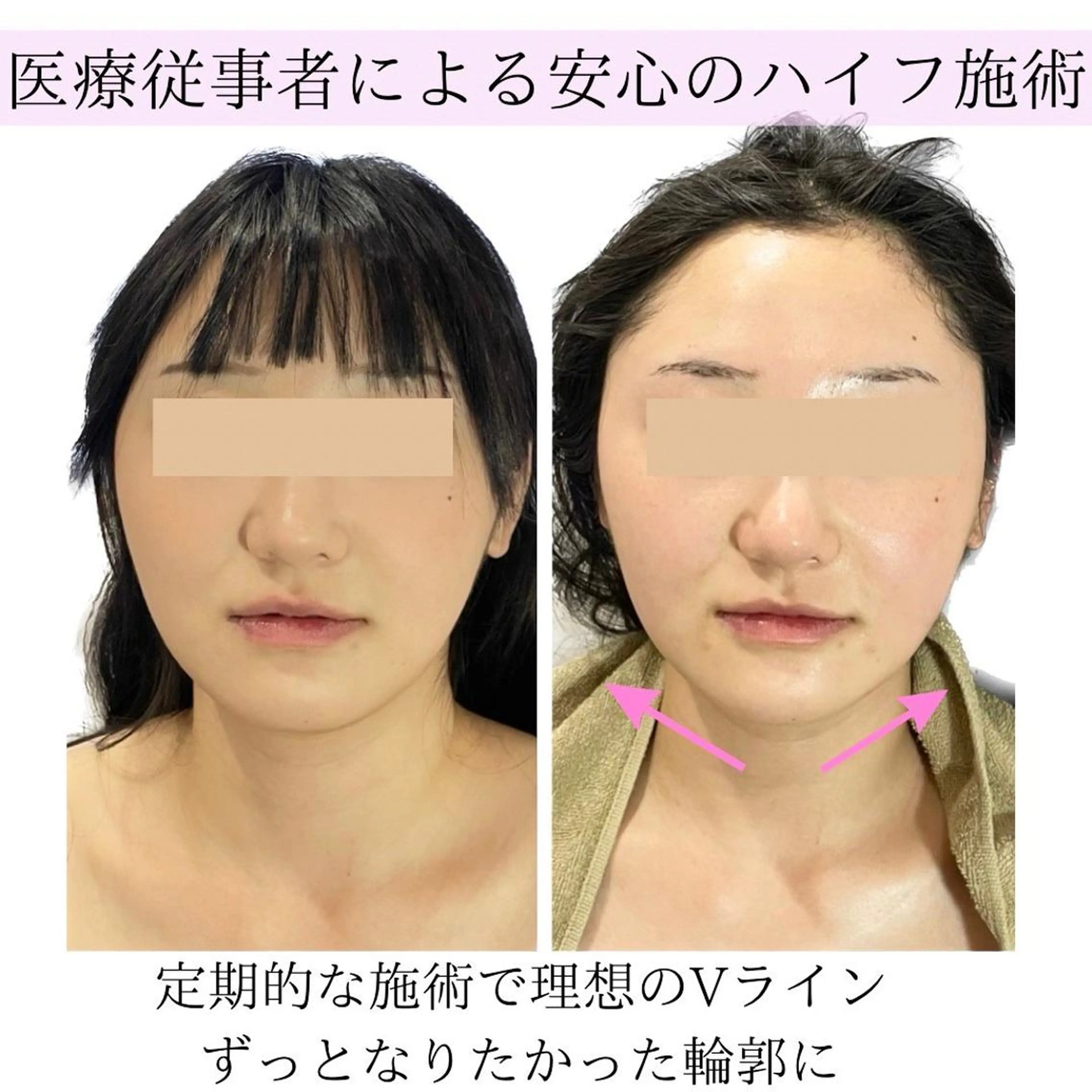 第一印象専門サロン ADISEのエステ・リラクイメージ