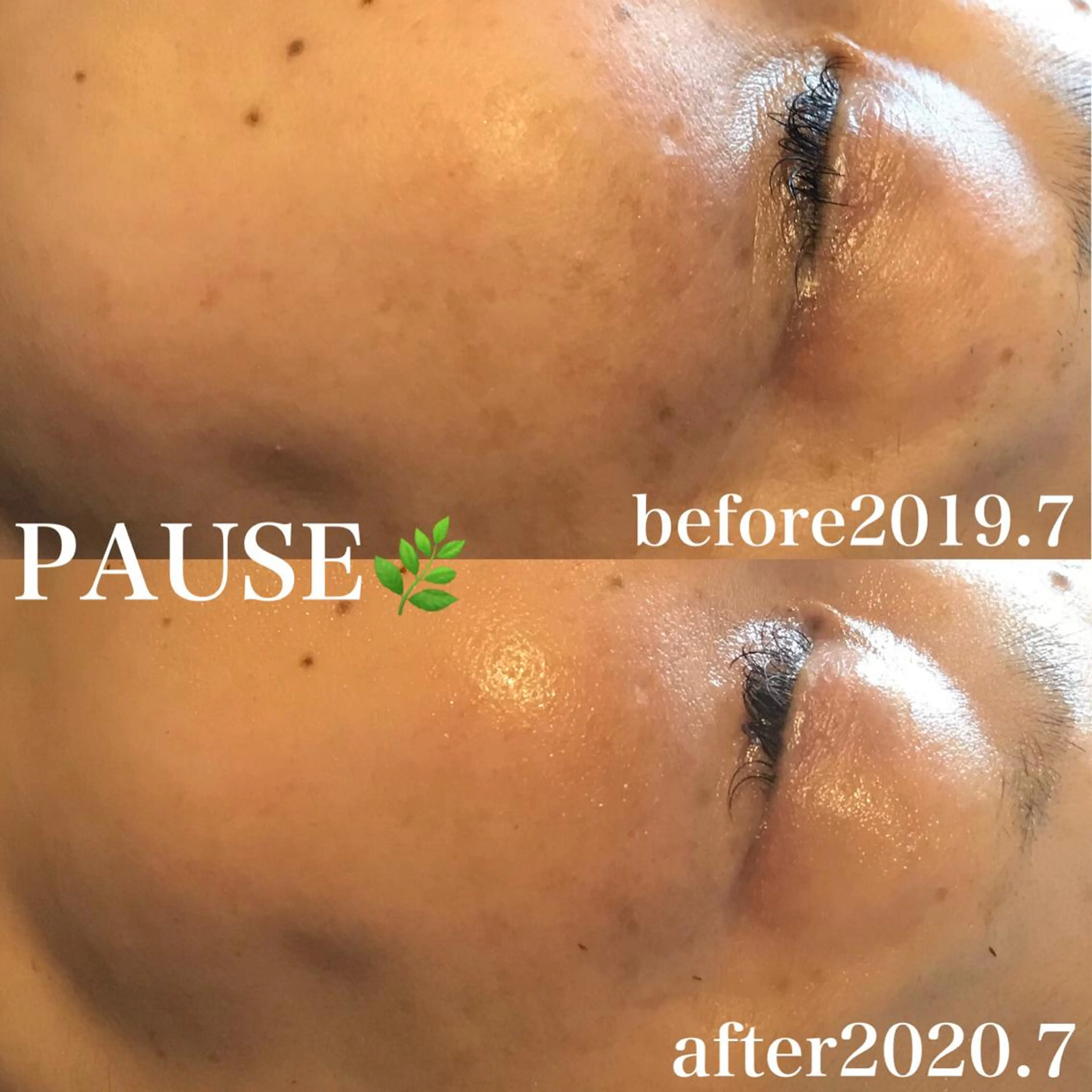 エステ 浜野 恵美のエステ・リラクイメージ