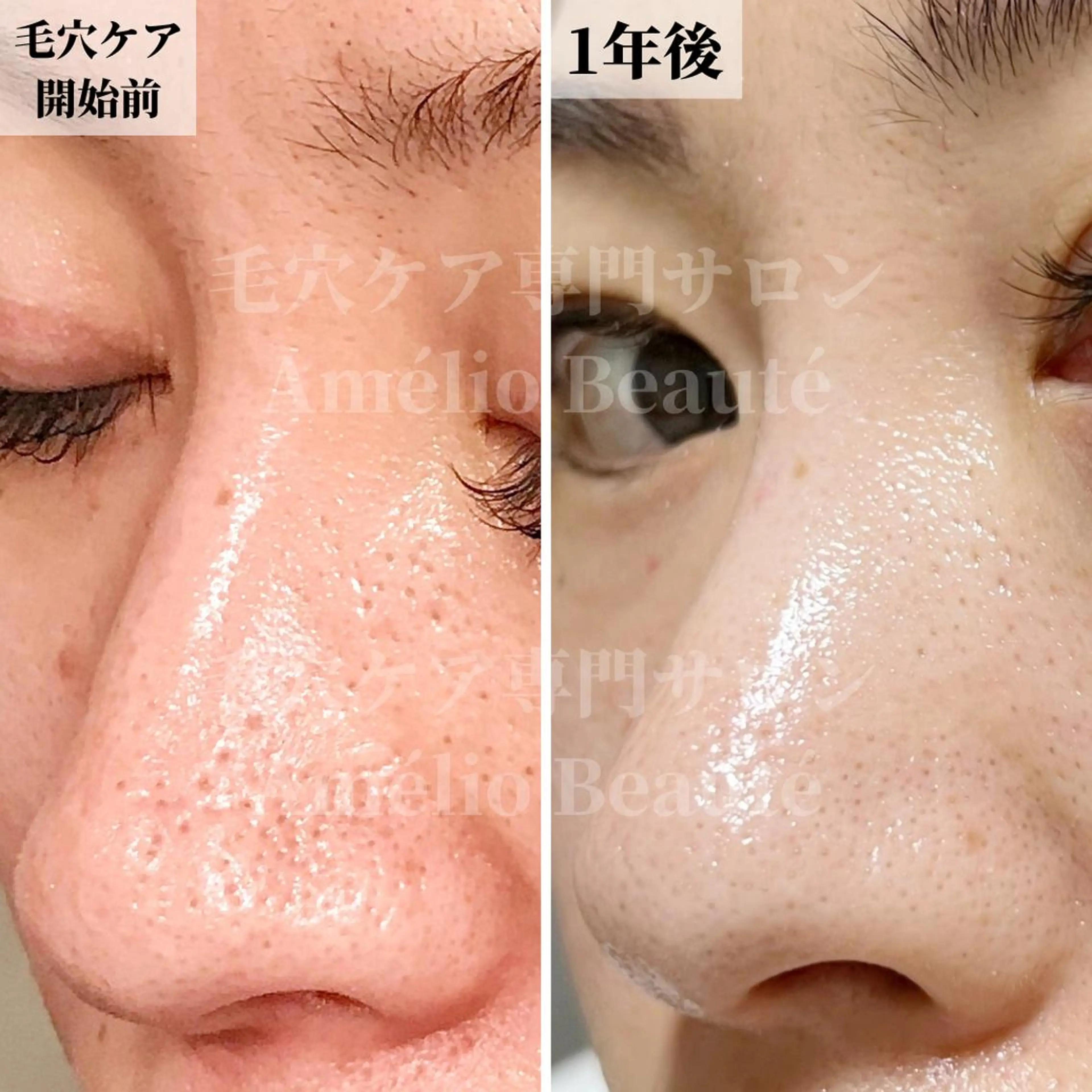 毛穴ケア専門サロン Amélio Beauté所属・毛穴ケア専門サロン アメリオボーテのその他イメージ