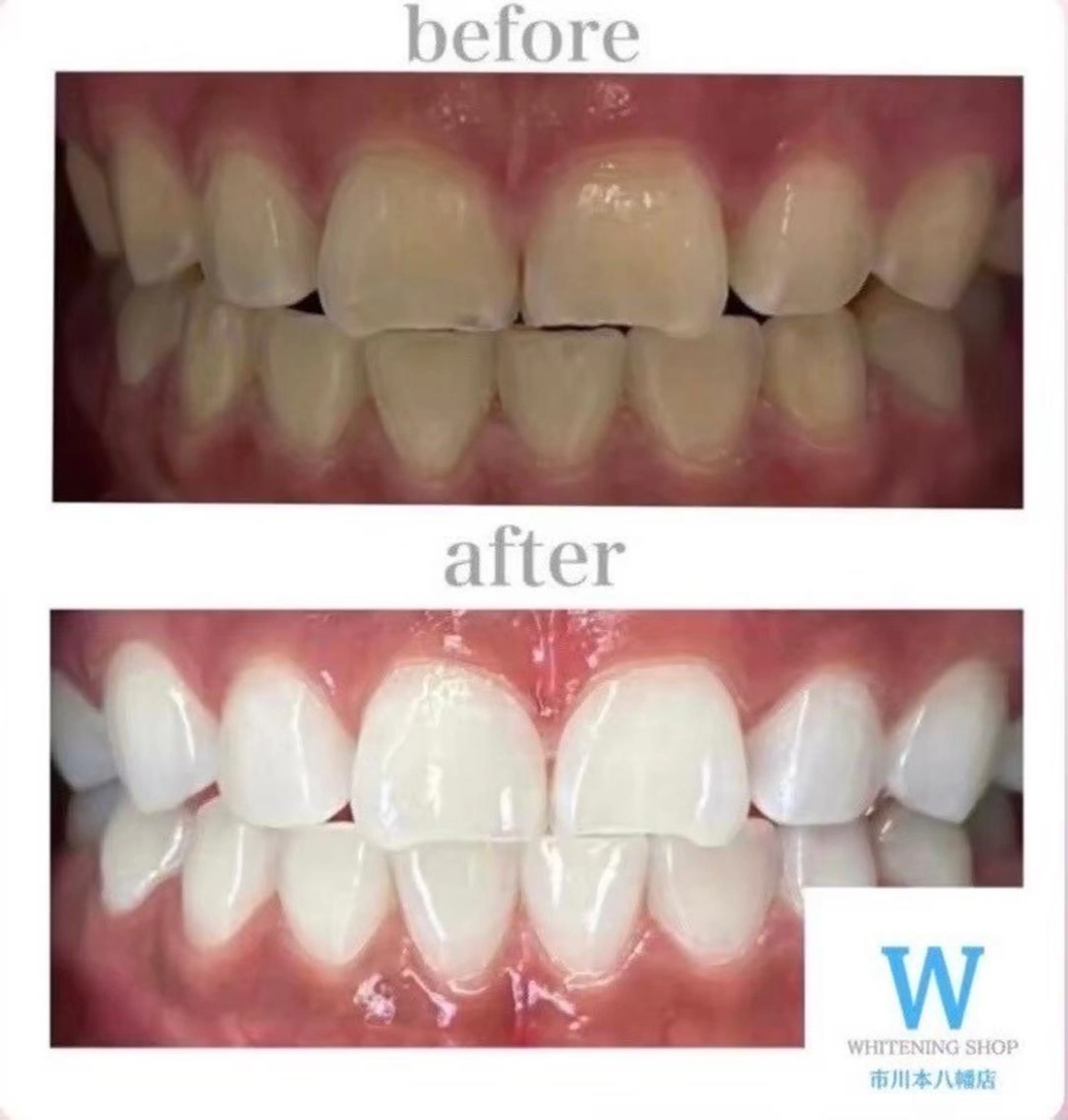 ホワイトニング ショップ本八幡店のエステ・リラクイメージ