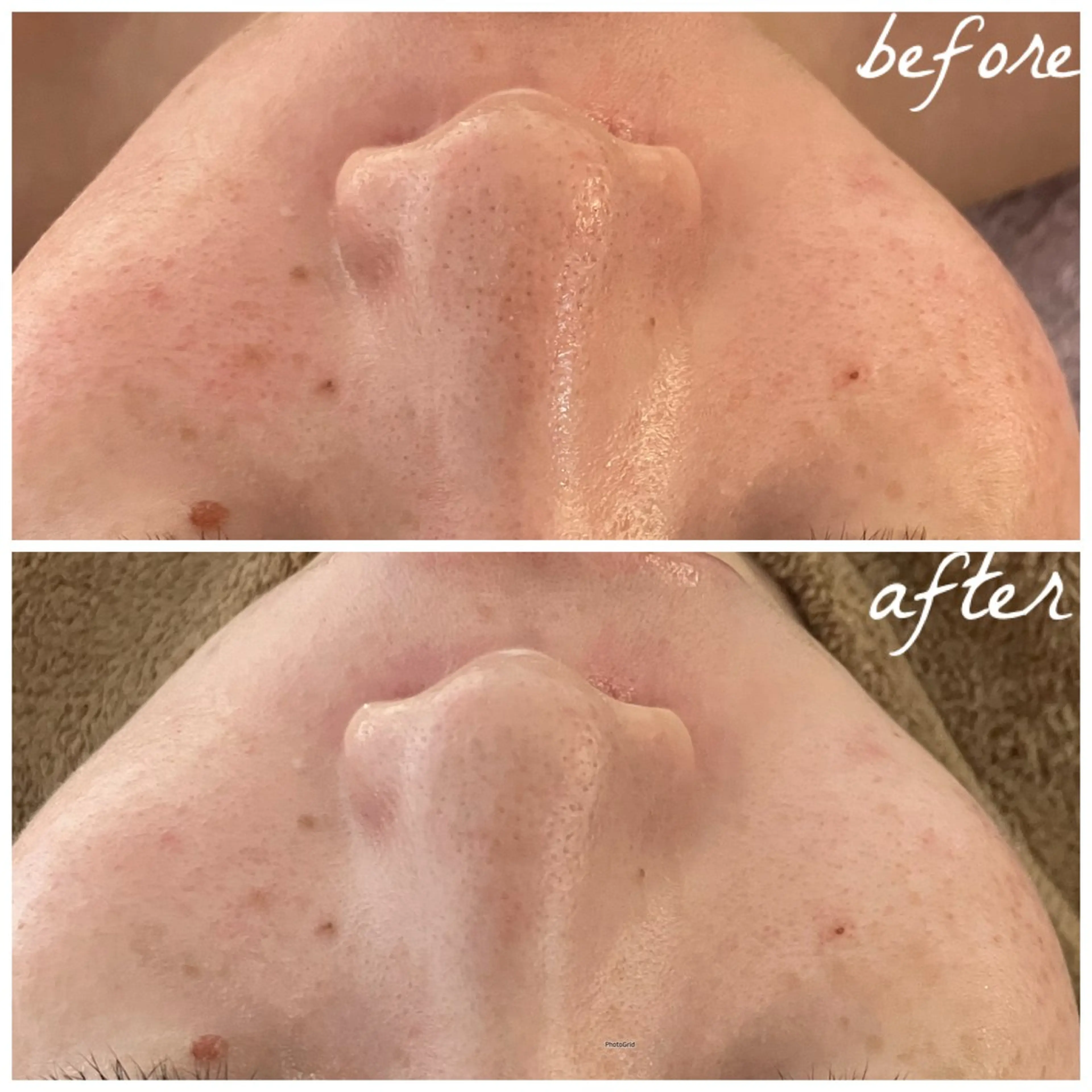 メンズ エステ メナード岐阜茜部 杉浦のエステ・リラクイメージ