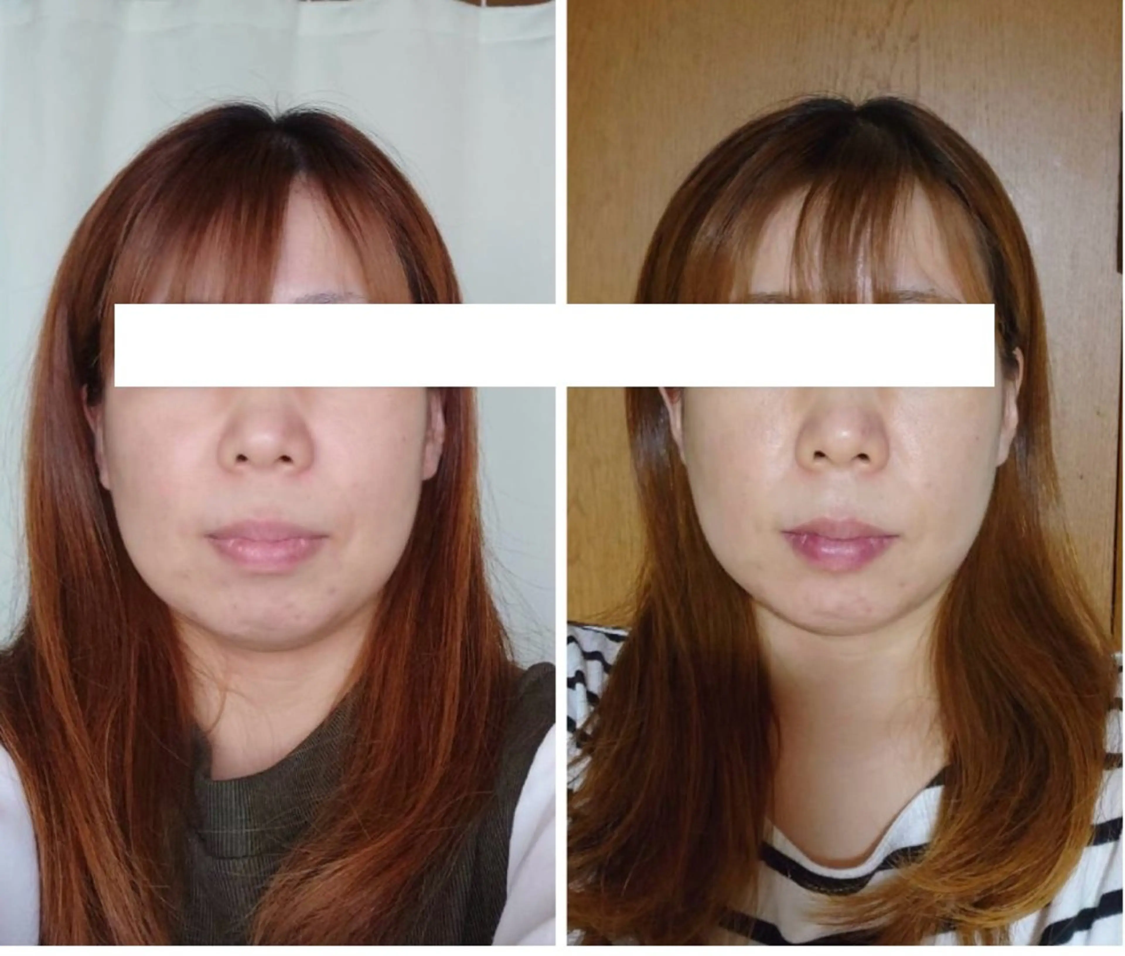 丸顔さんの救世主 高田 くみのエステ・リラクイメージ