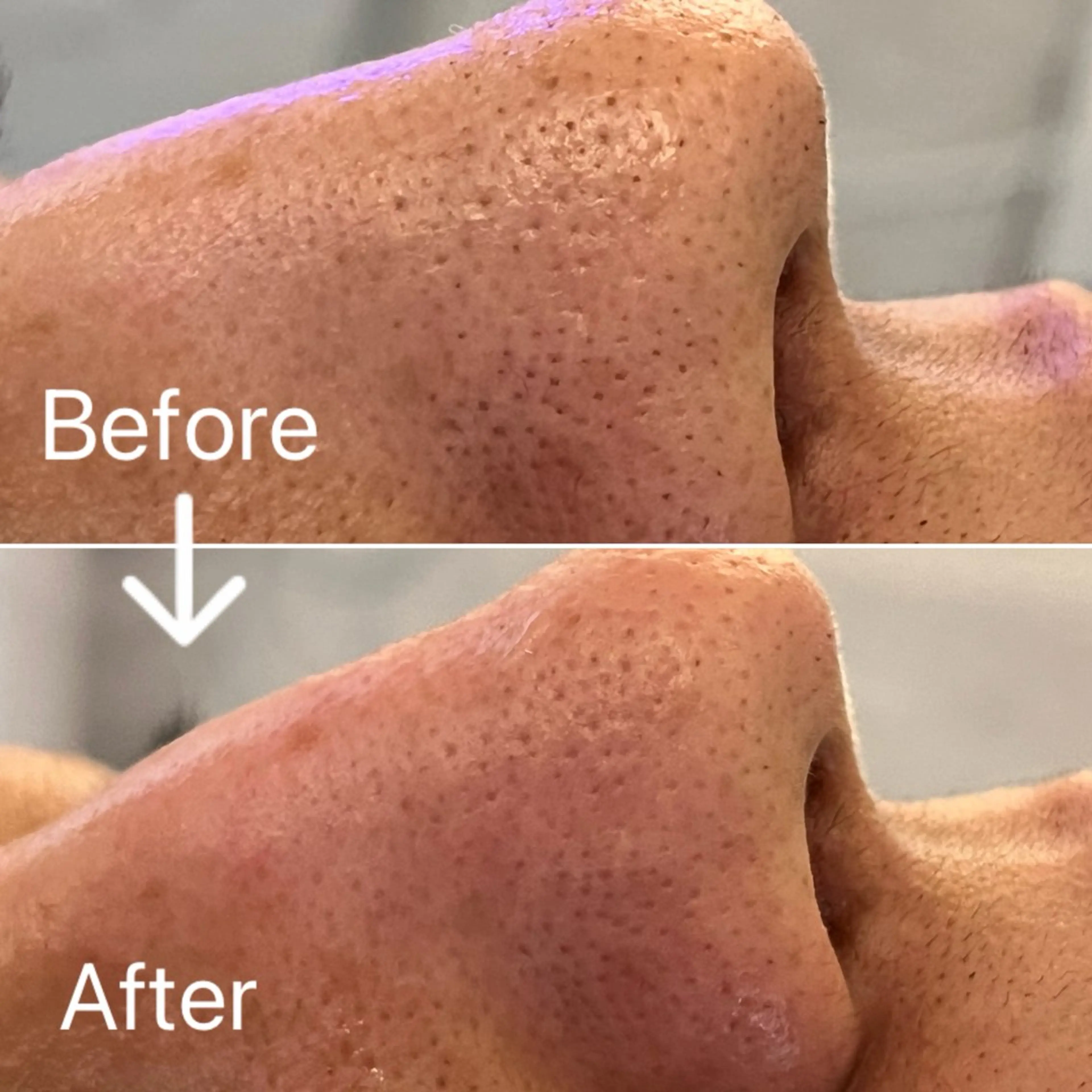 Blue Moon 【ブルームーン】のエステ・リラクイメージ