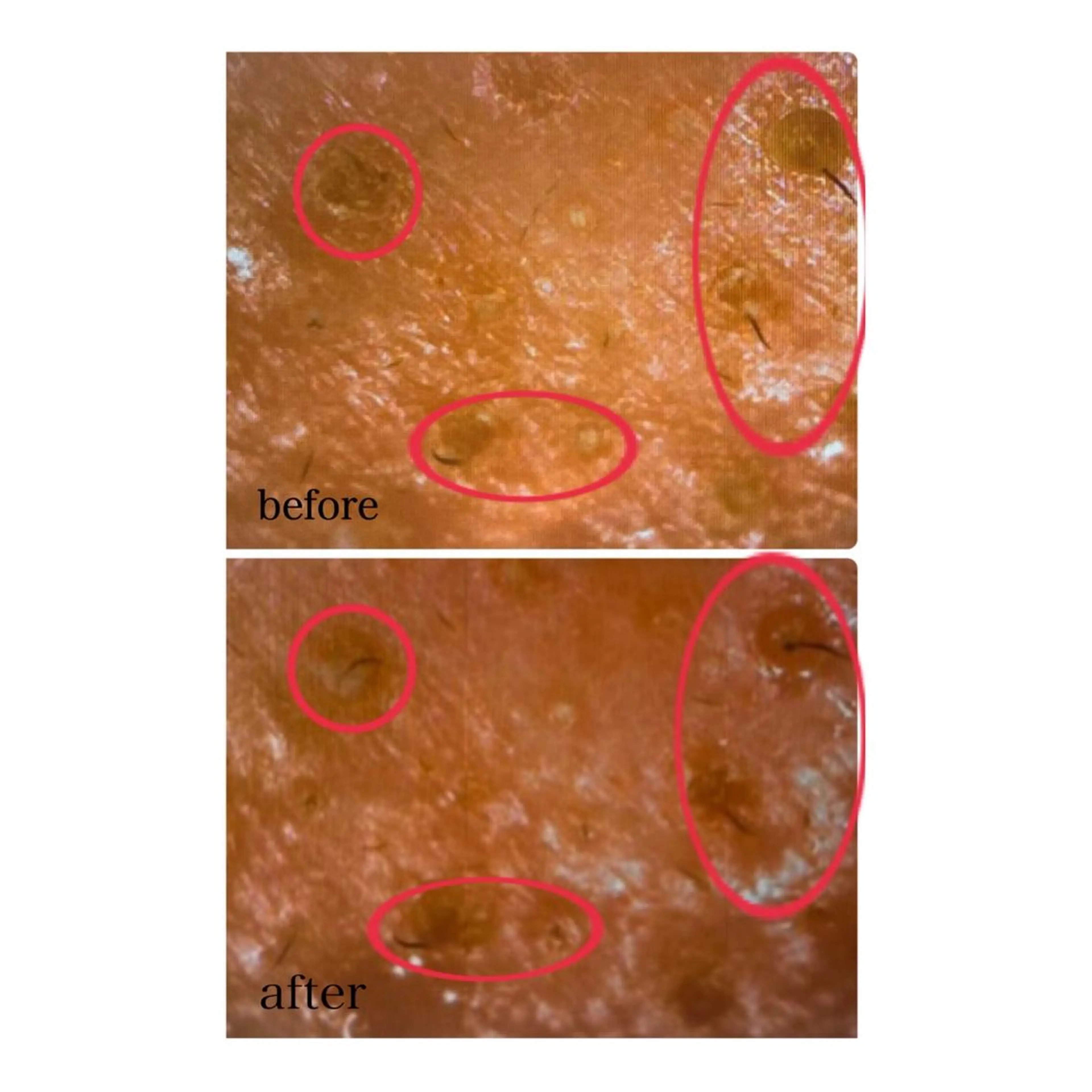 Lien~毛穴 専門サロンのその他イメージ