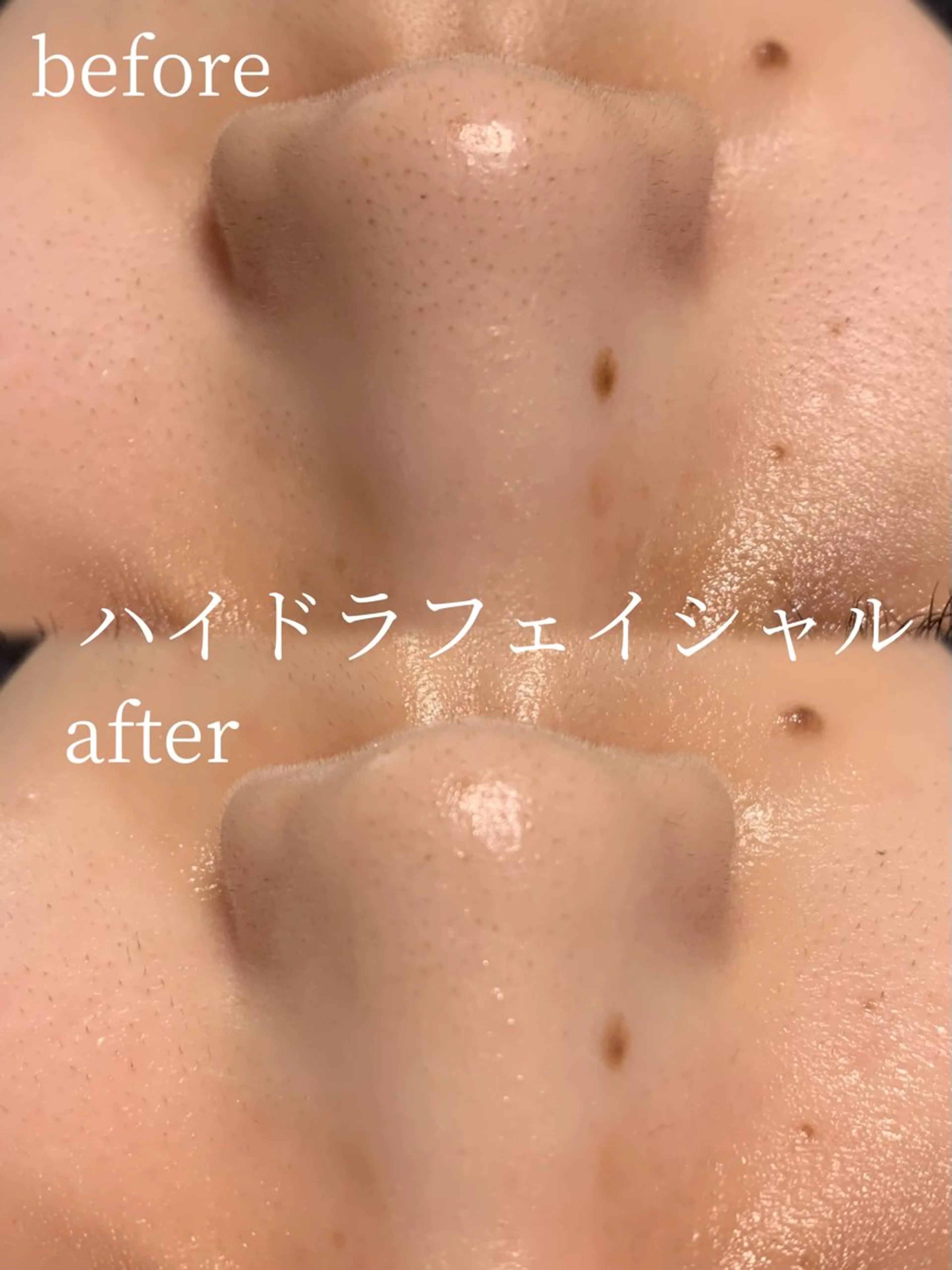 エステ リラク lifra CHISAのマツエク・マツパデザイン