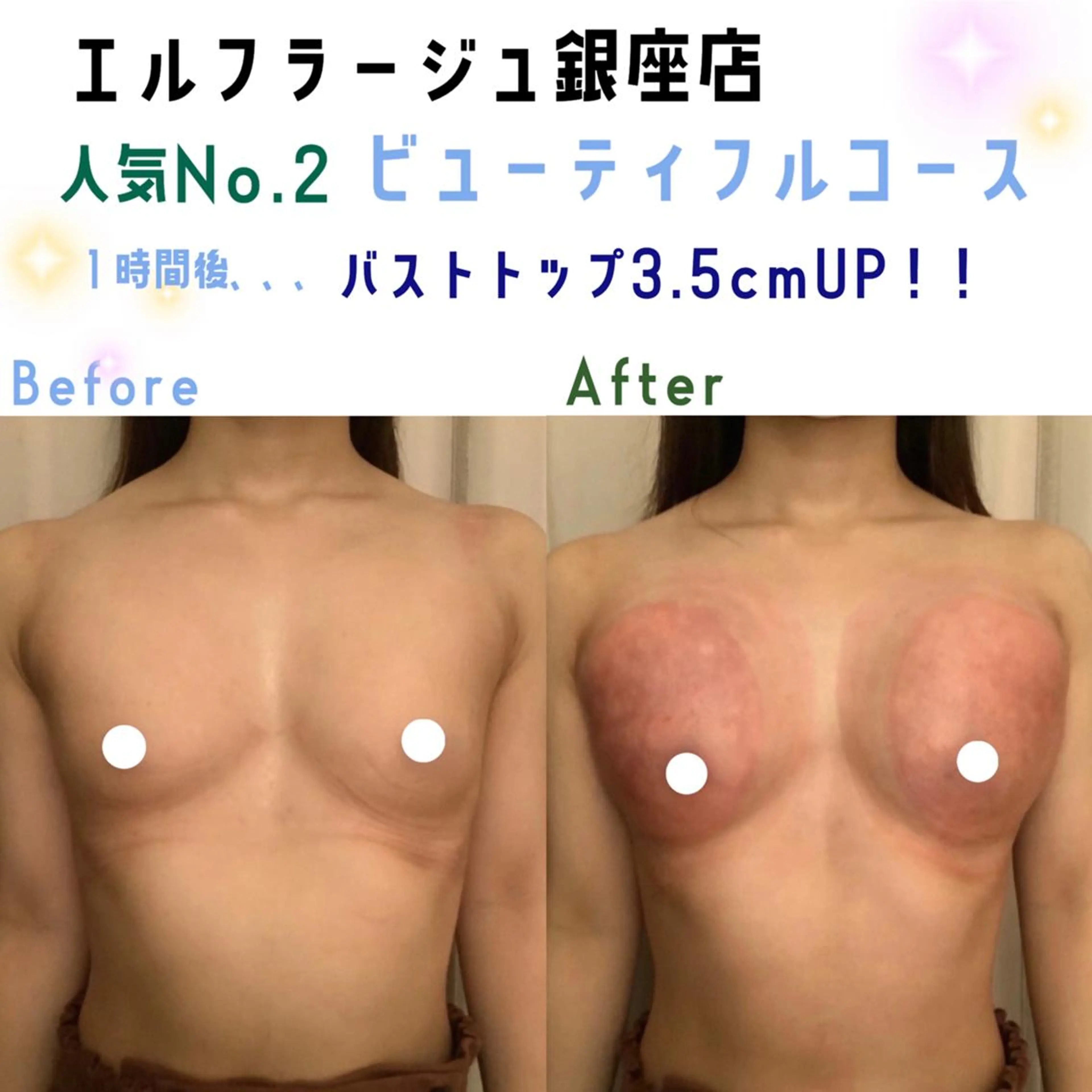 エルフラージュ 銀座店のエステ・リラクイメージ