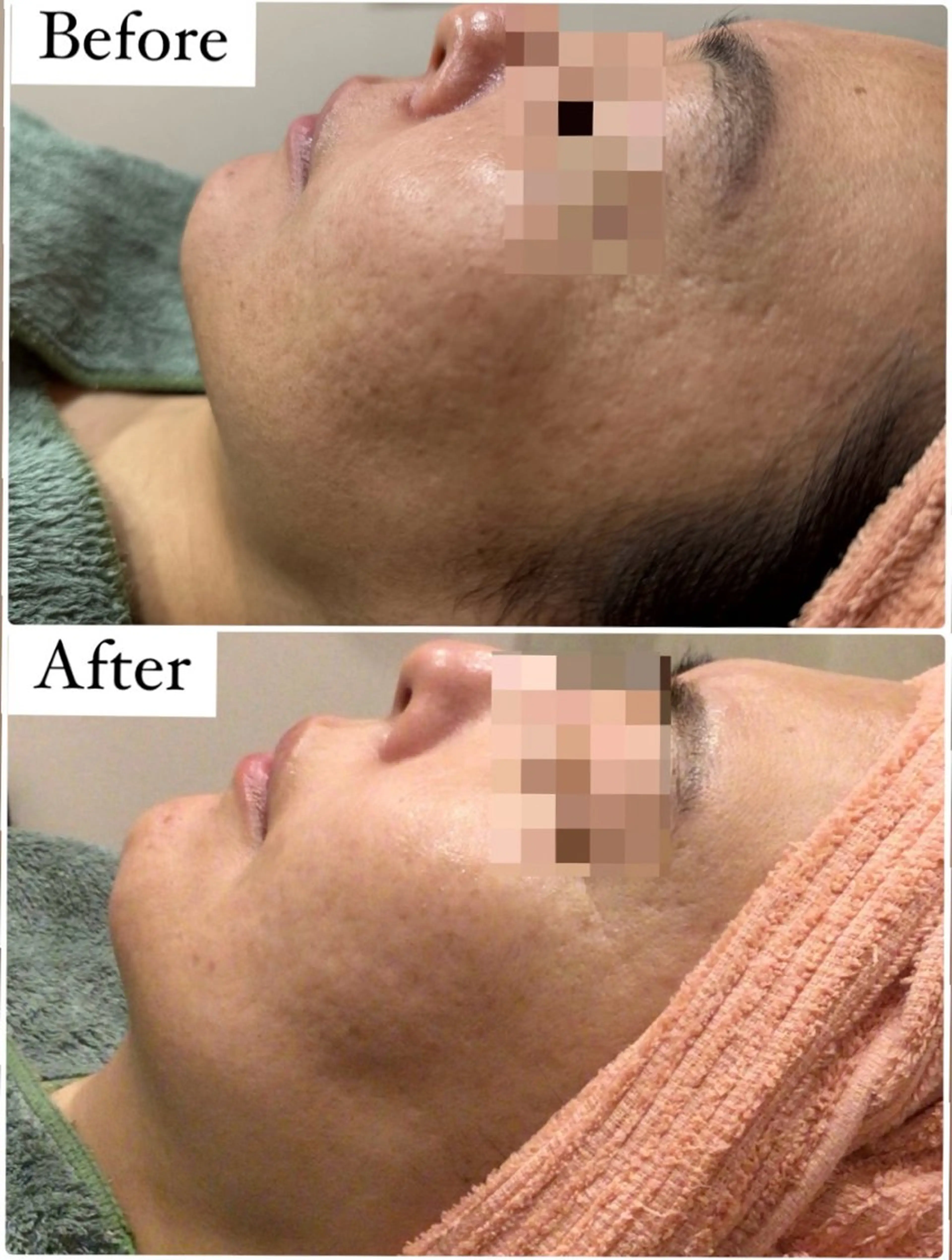 ハーブピーリング専門 muro.のエステ・リラクイメージ