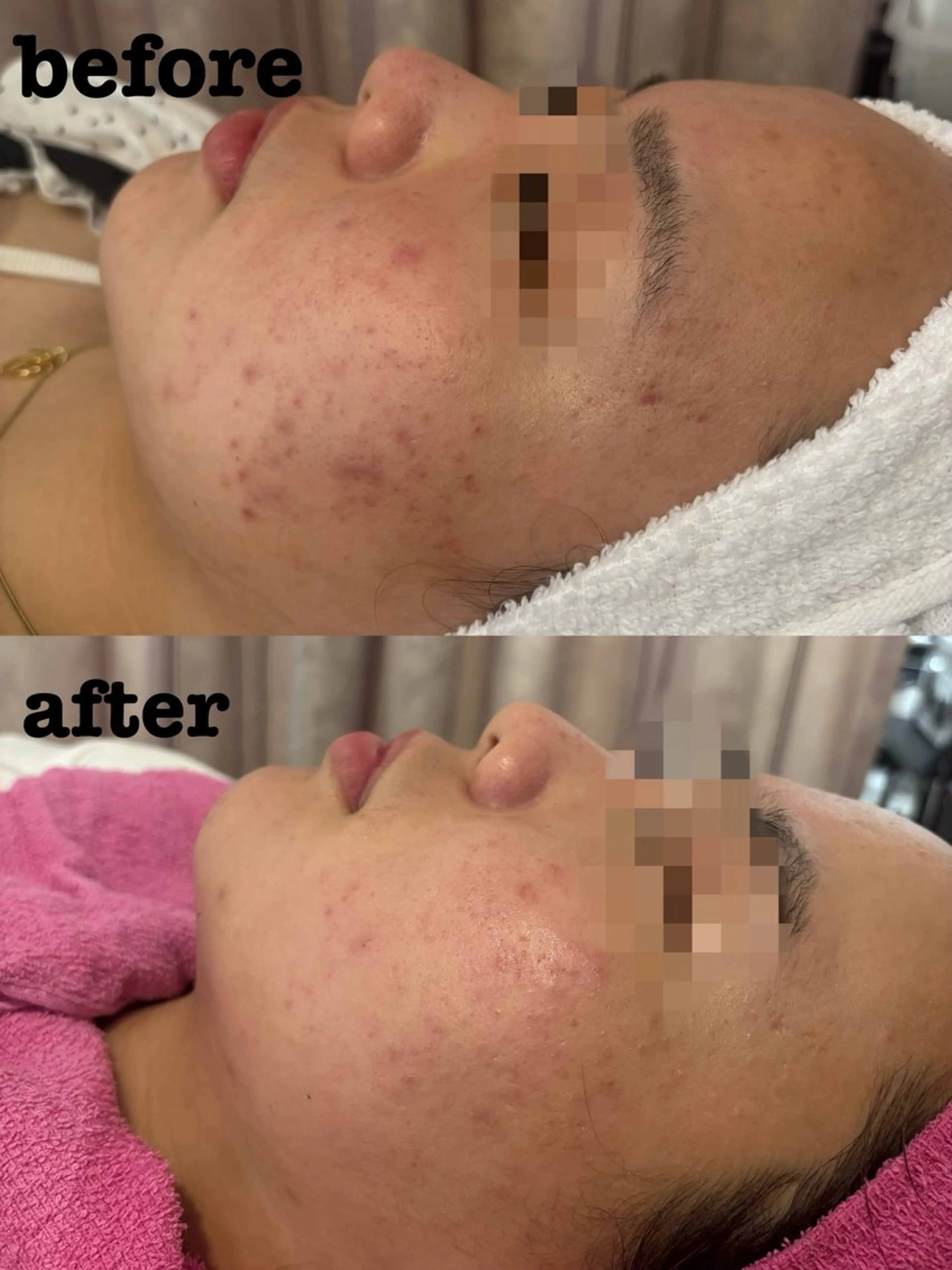 エレグラム所属・雑賀 由衣のエステ・リラクイメージ