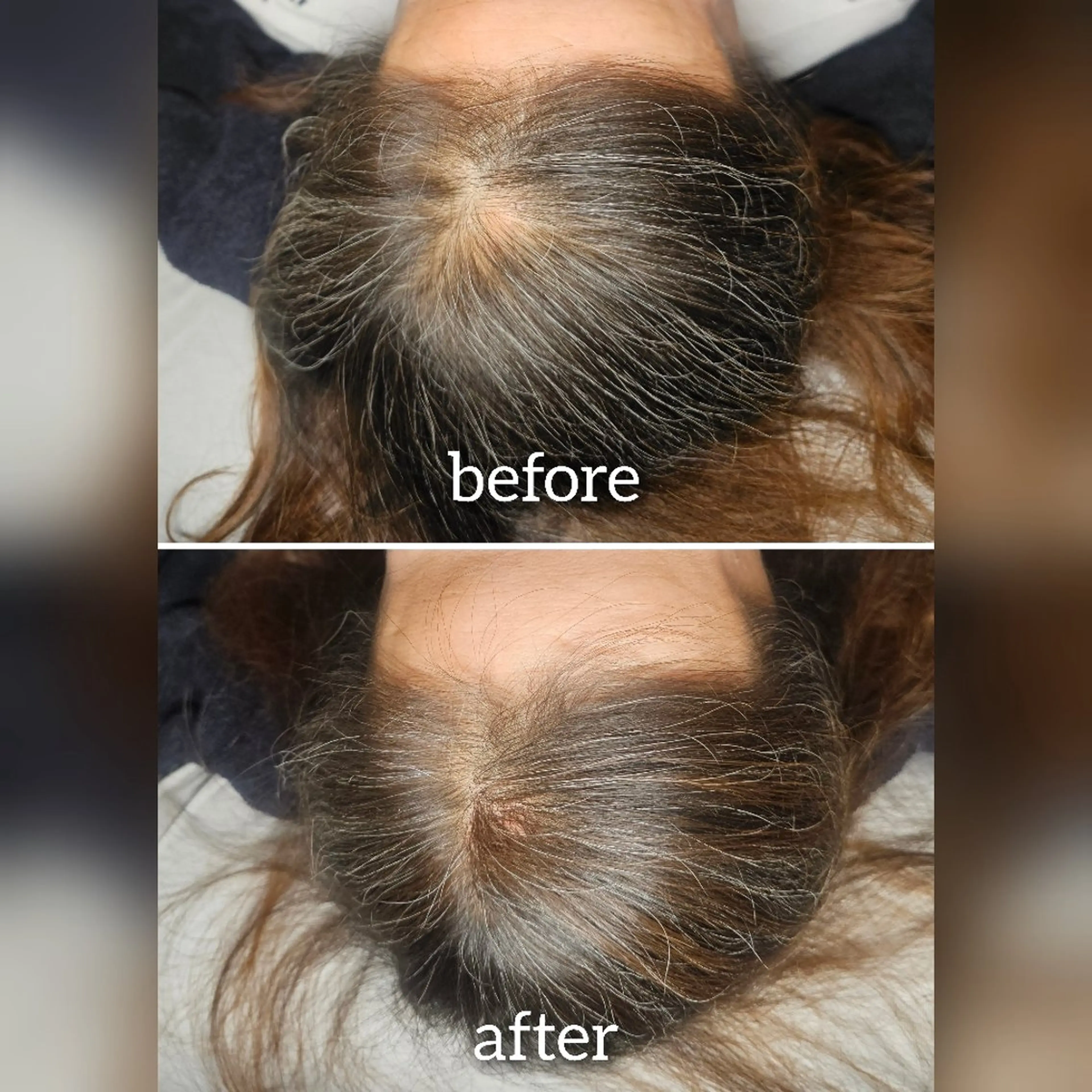 ヘアアレンジ 歯科提携セルフダック 宇都宮駒生店のエステ・リラクイメージ