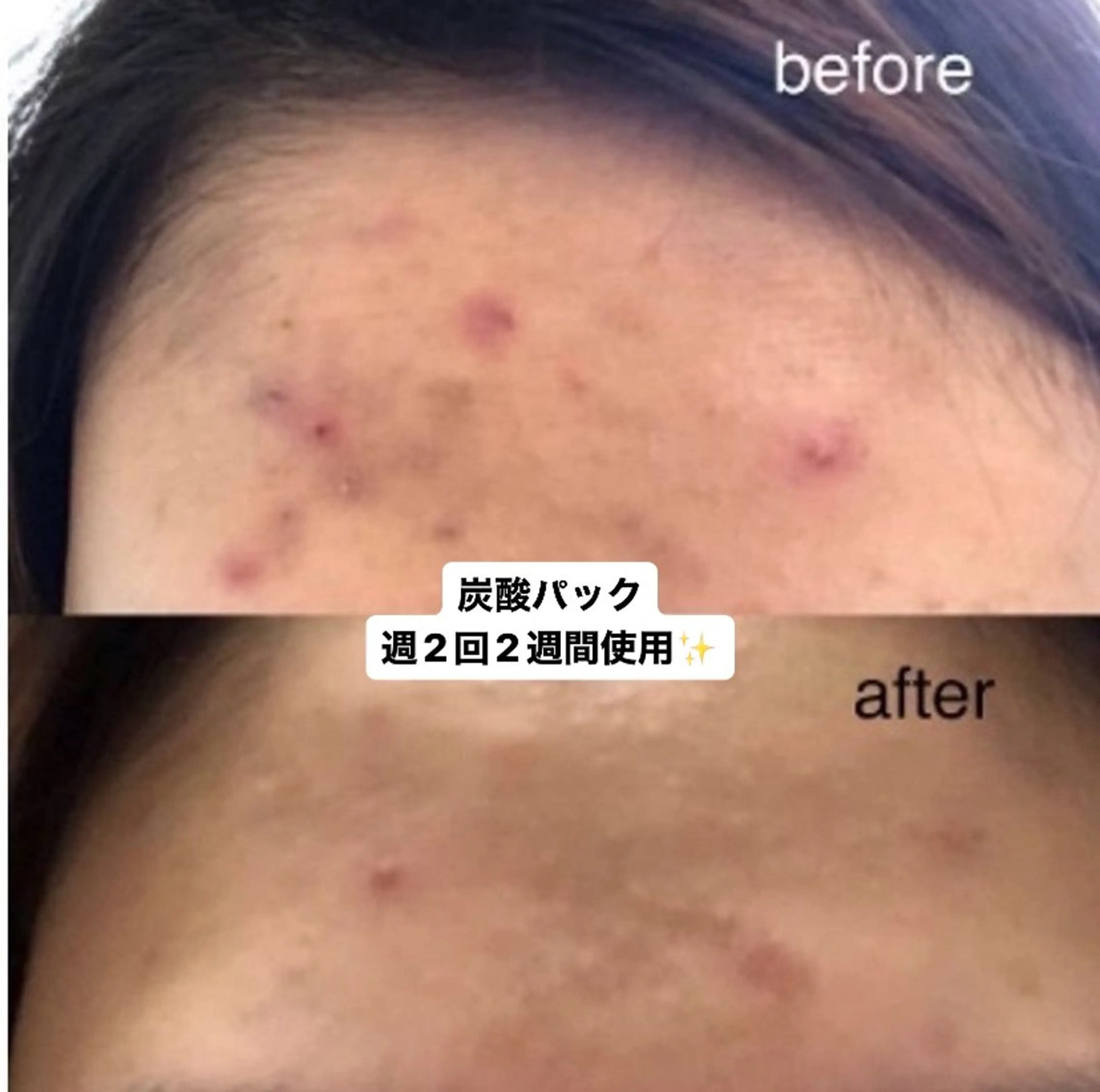 脱毛・エステサロン LuLuNのエステ・リラクイメージ