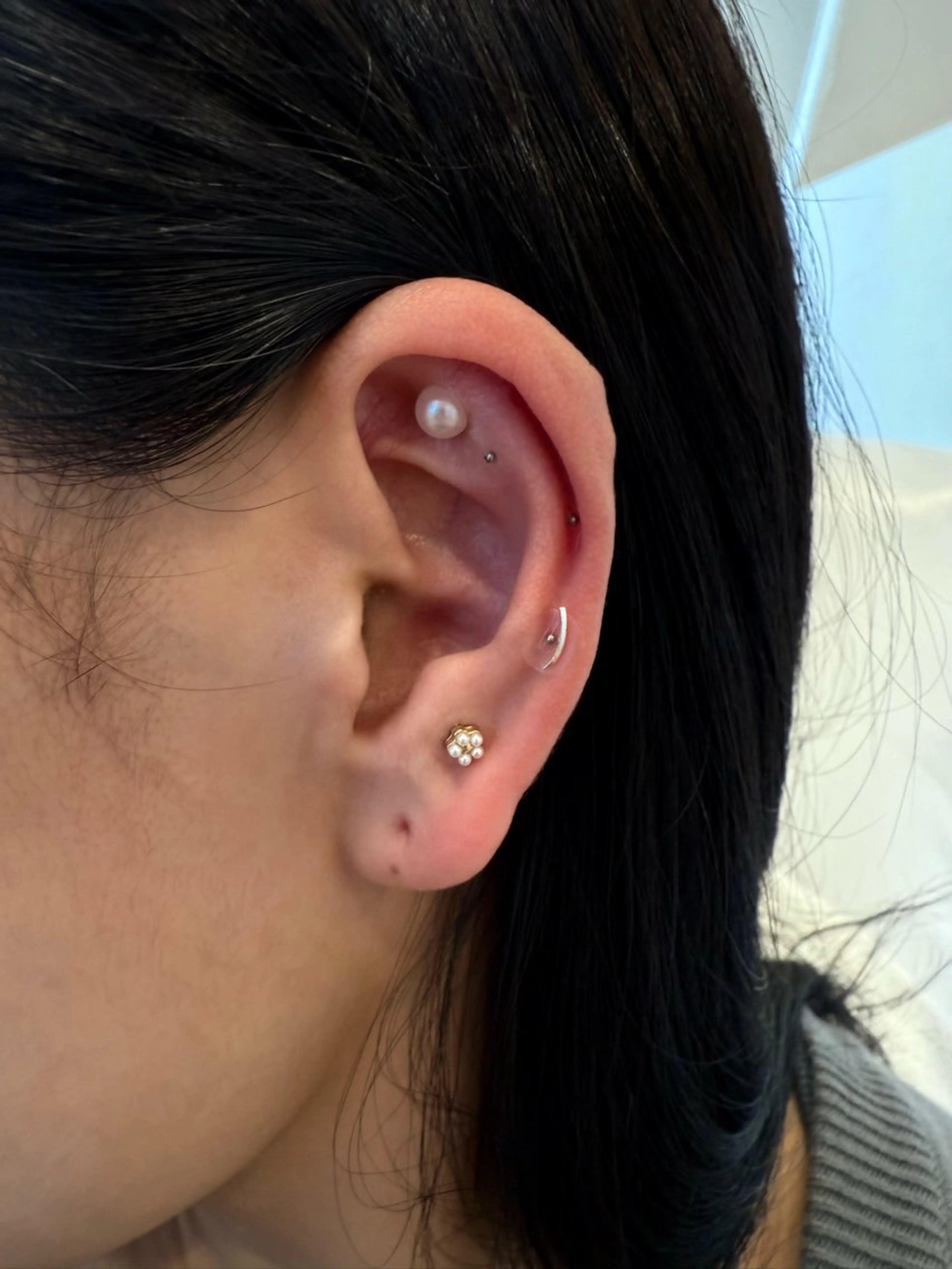 ADDICT中目黒店所属・毛穴洗浄/毛穴ケア 🌿中目黒🌿のエステ・リラクイメージ