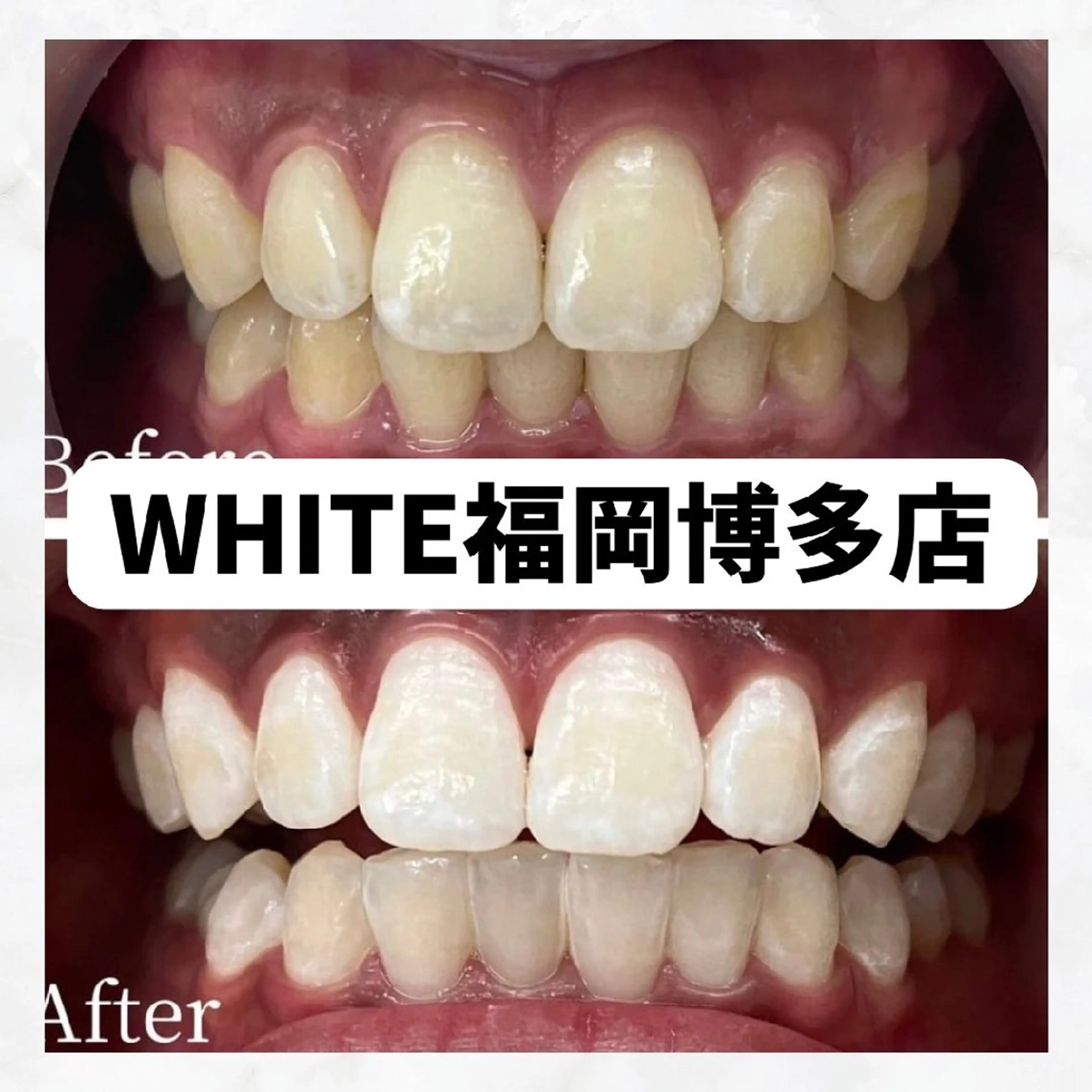 メンズ 撮影モデル セルフホワイトニング WHITE福岡博多店のエステ・リラクイメージ