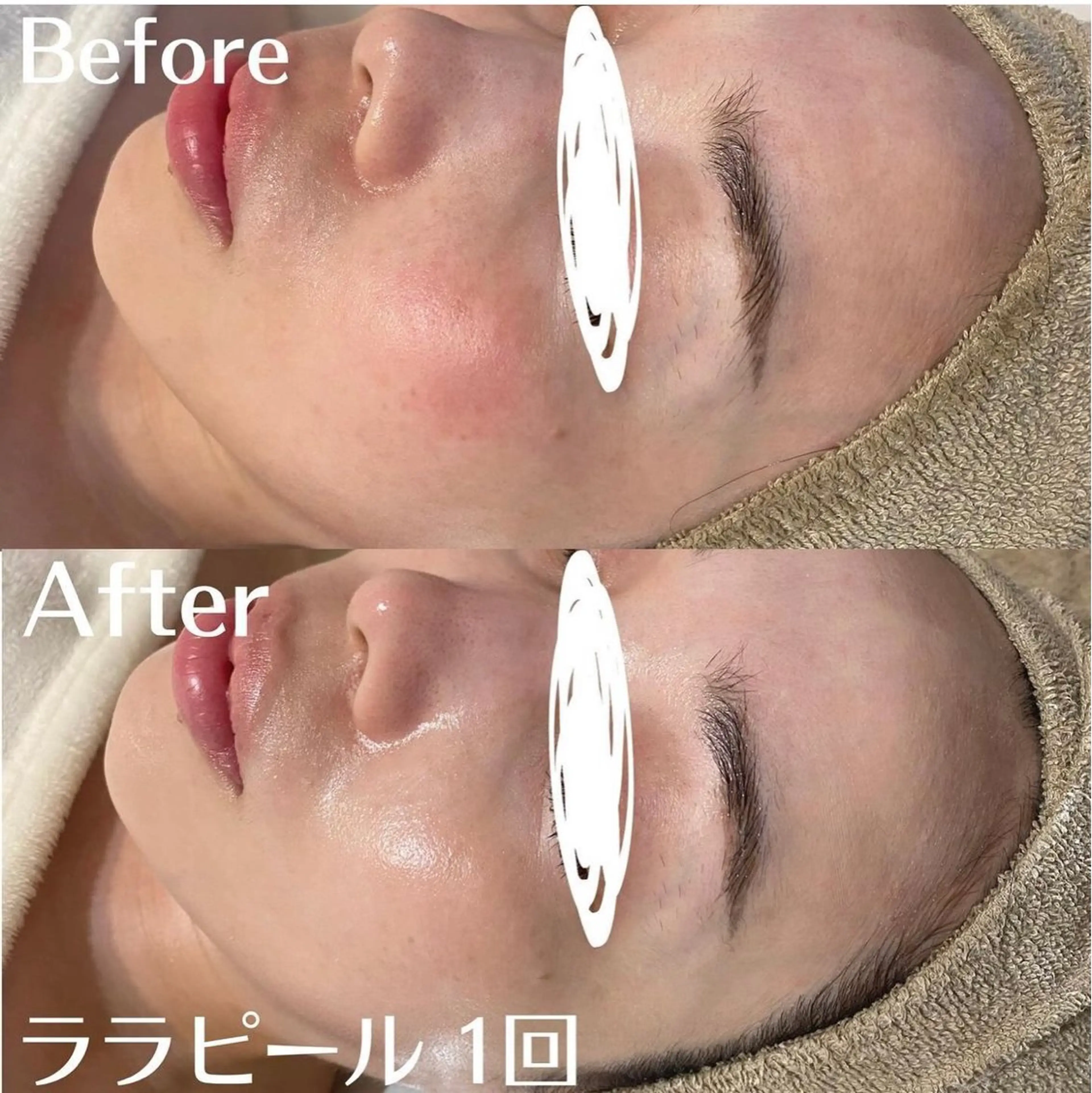 中目黒ハーブピーリン グ🌿ララピールのエステ・リラクイメージ