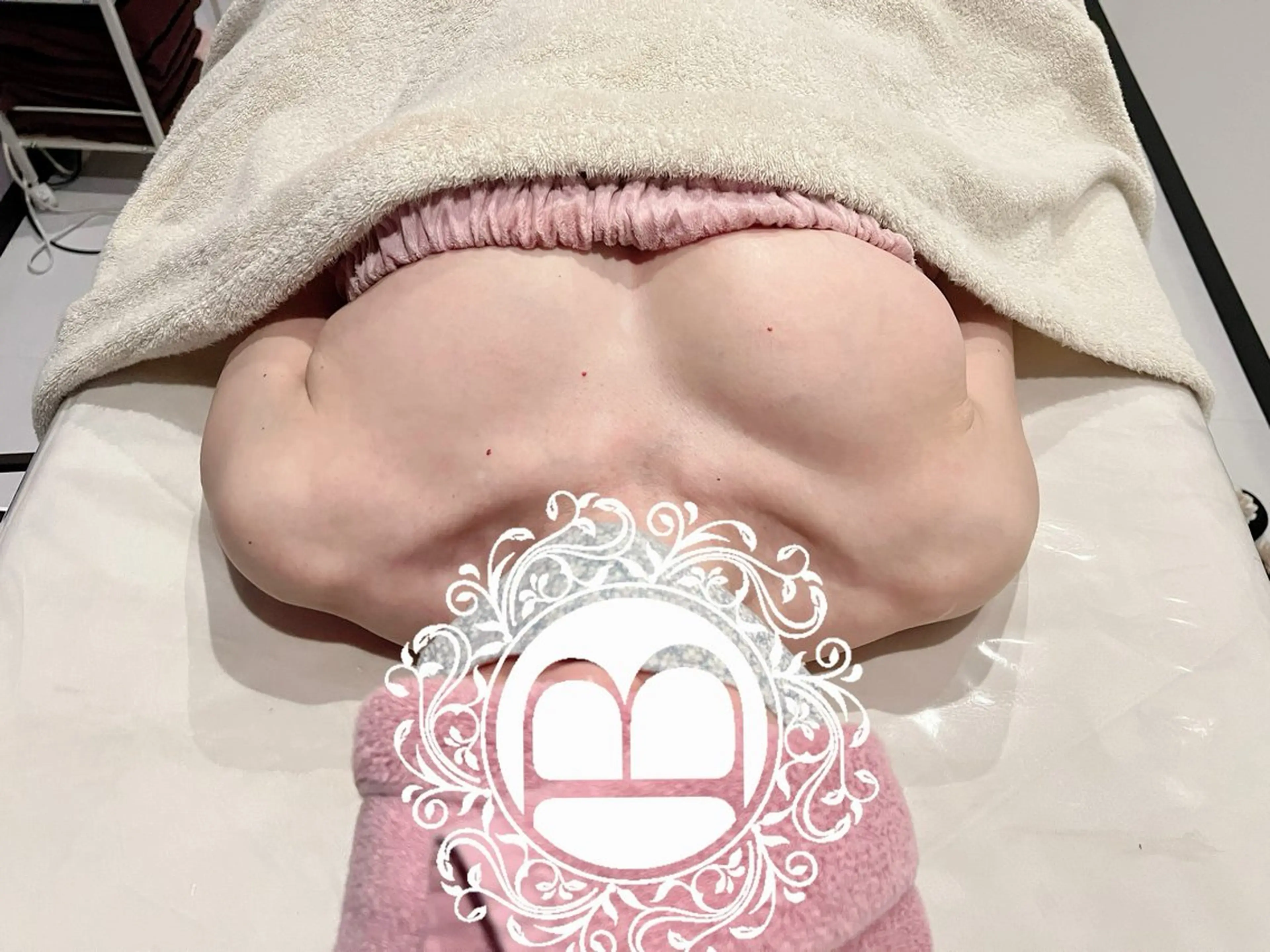 仙台人気No.1【メスを使わない豊胸ミラクルバストプレミアム】の写真