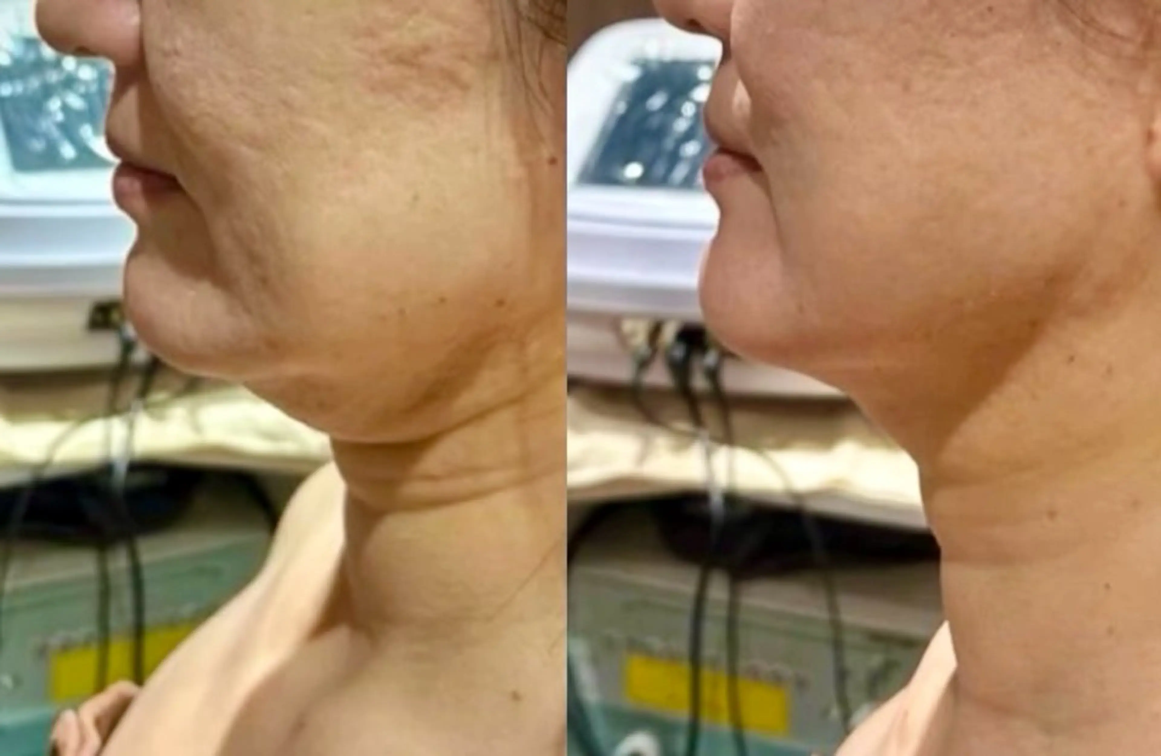 看護師が施術する美容 ナスサロ／小泉のエステ・リラクイメージ