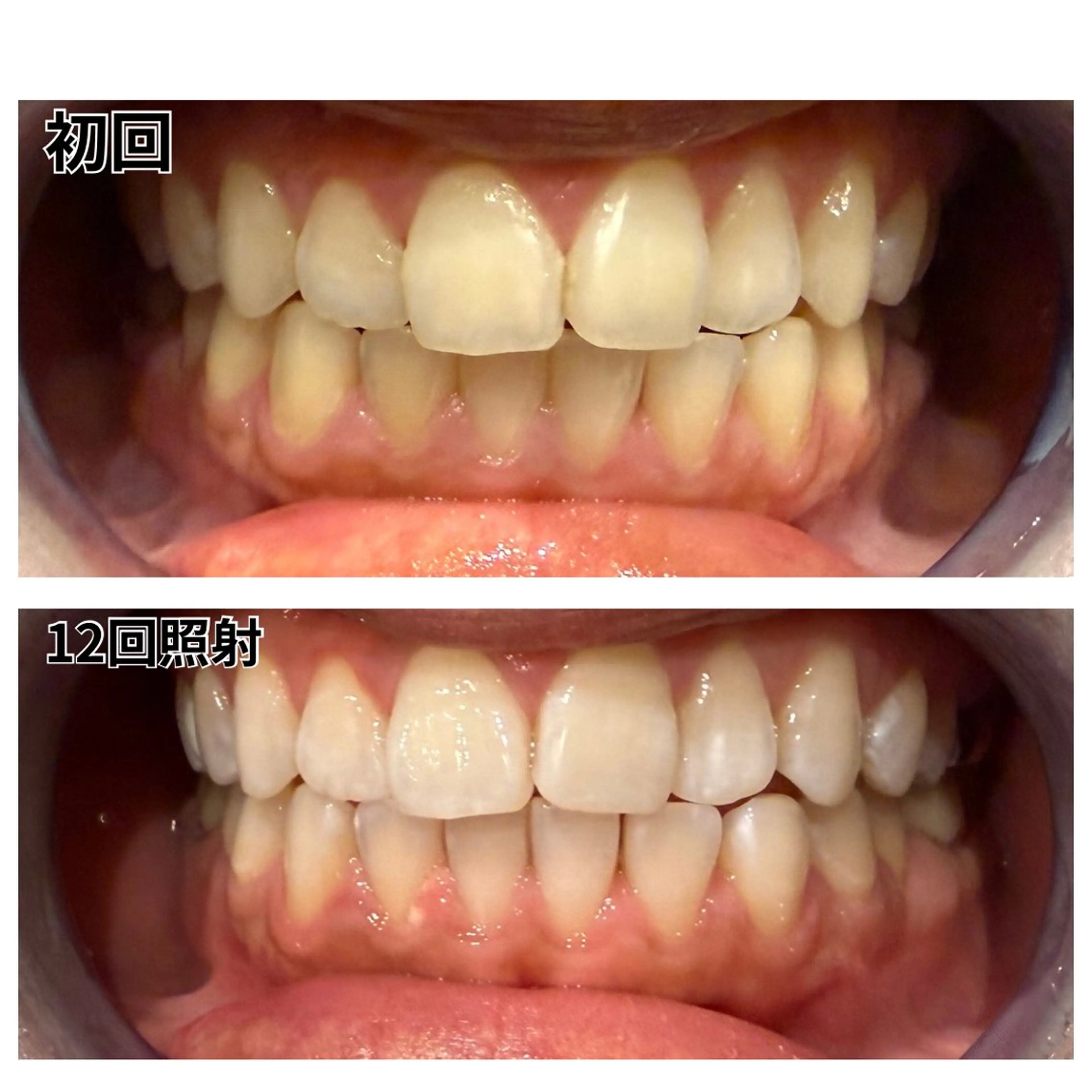 セルフホワイトニング　アデル所属・戸嶋 菫のエステ・リラクイメージ