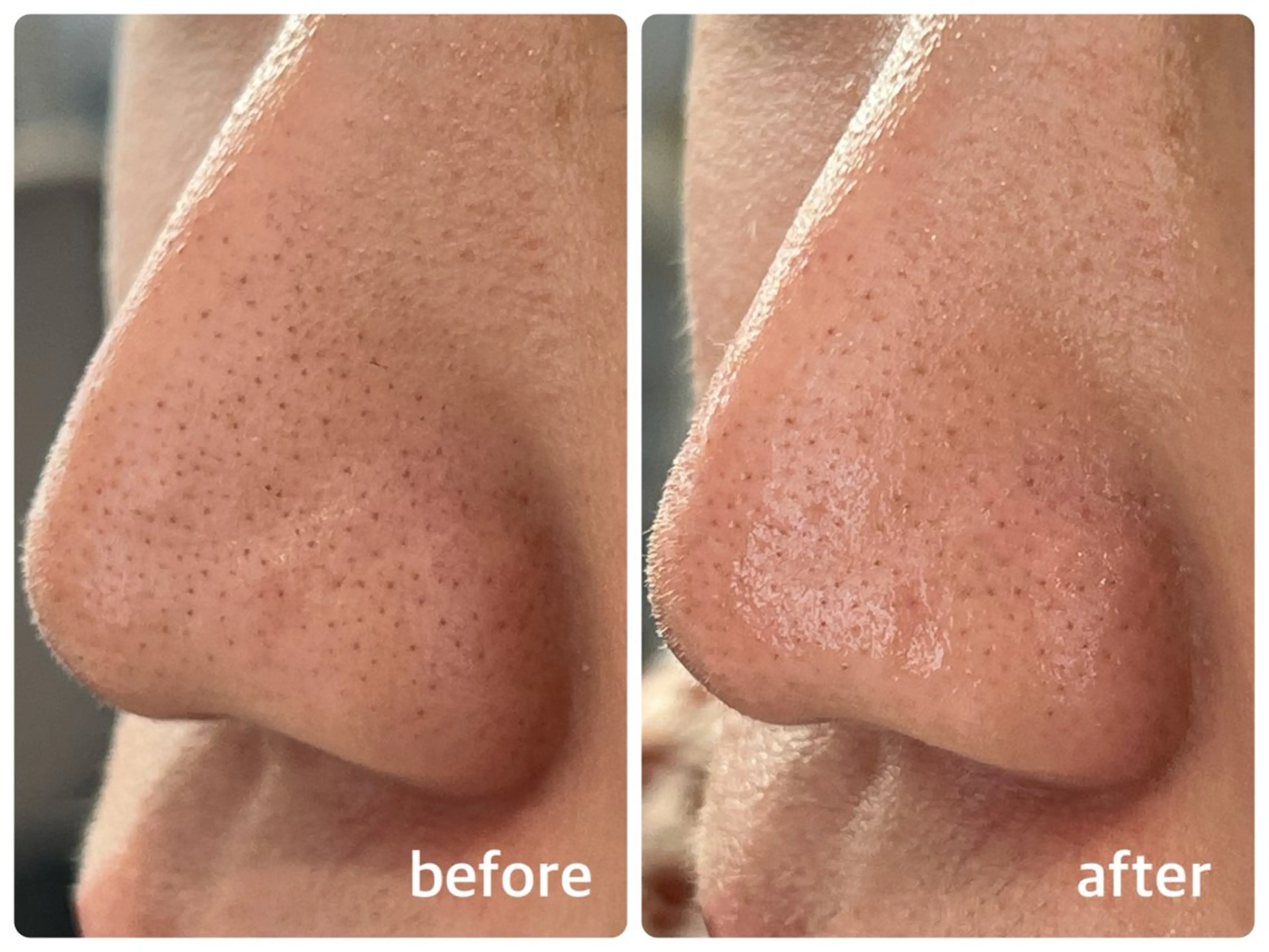 ナリス化粧品 Yumenaのエステ・リラクイメージ