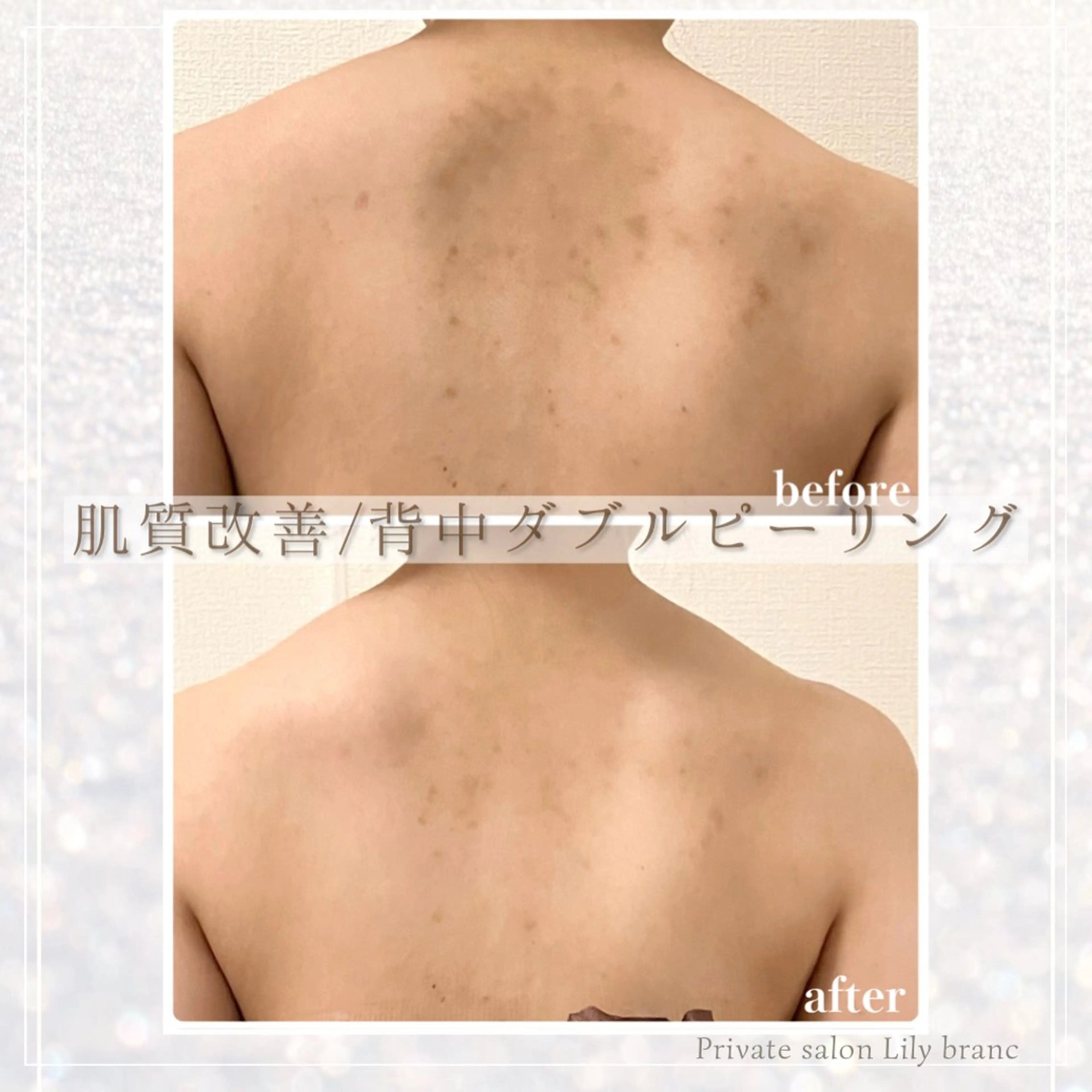 その他 Lily branc 痩身/小顔/肌質改善のエステ・リラクイメージ