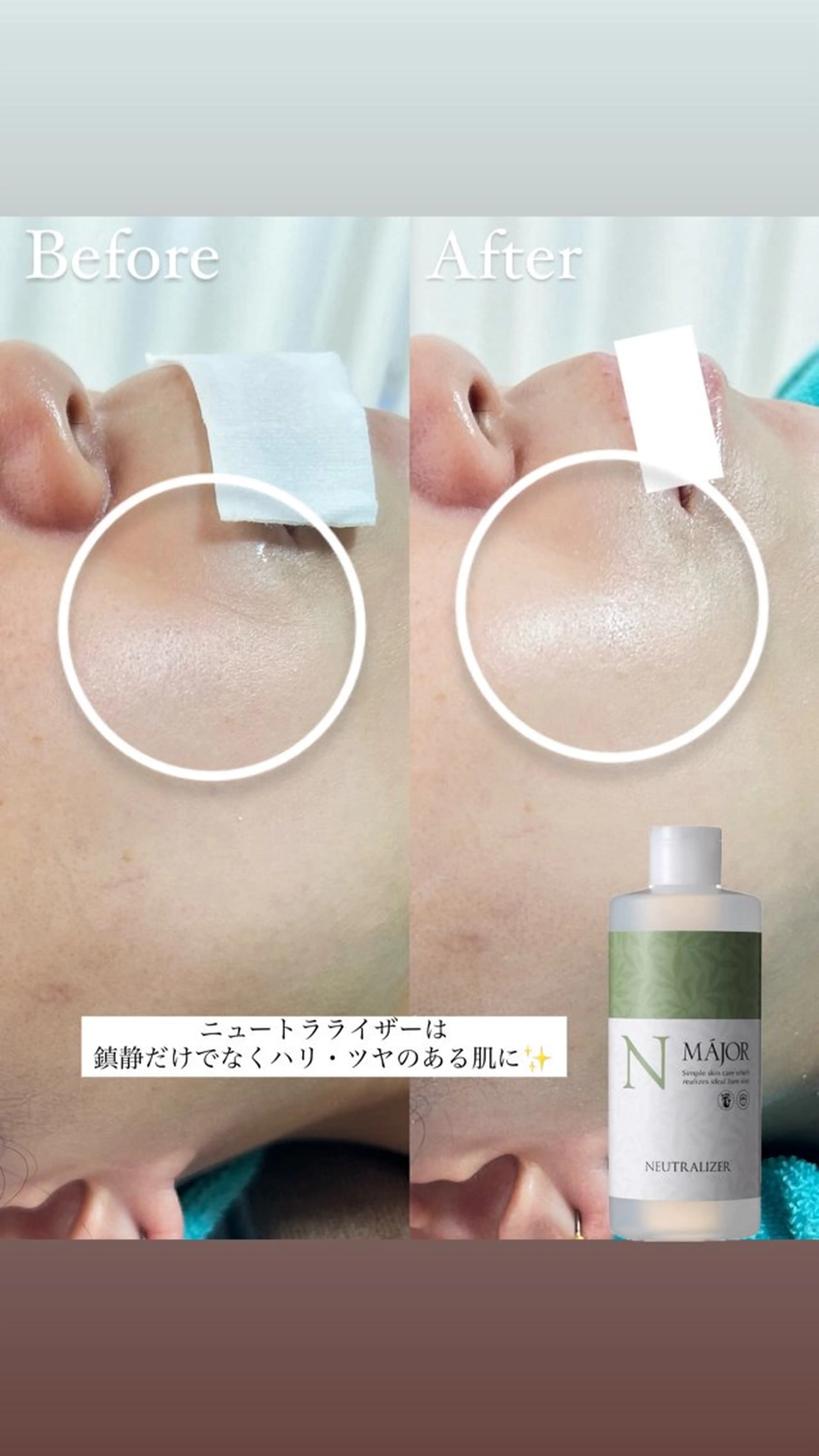 エステ 都度払い制脱毛サロンBe Charm所属・Be Charm 山﨑のエステ・リラクイメージ