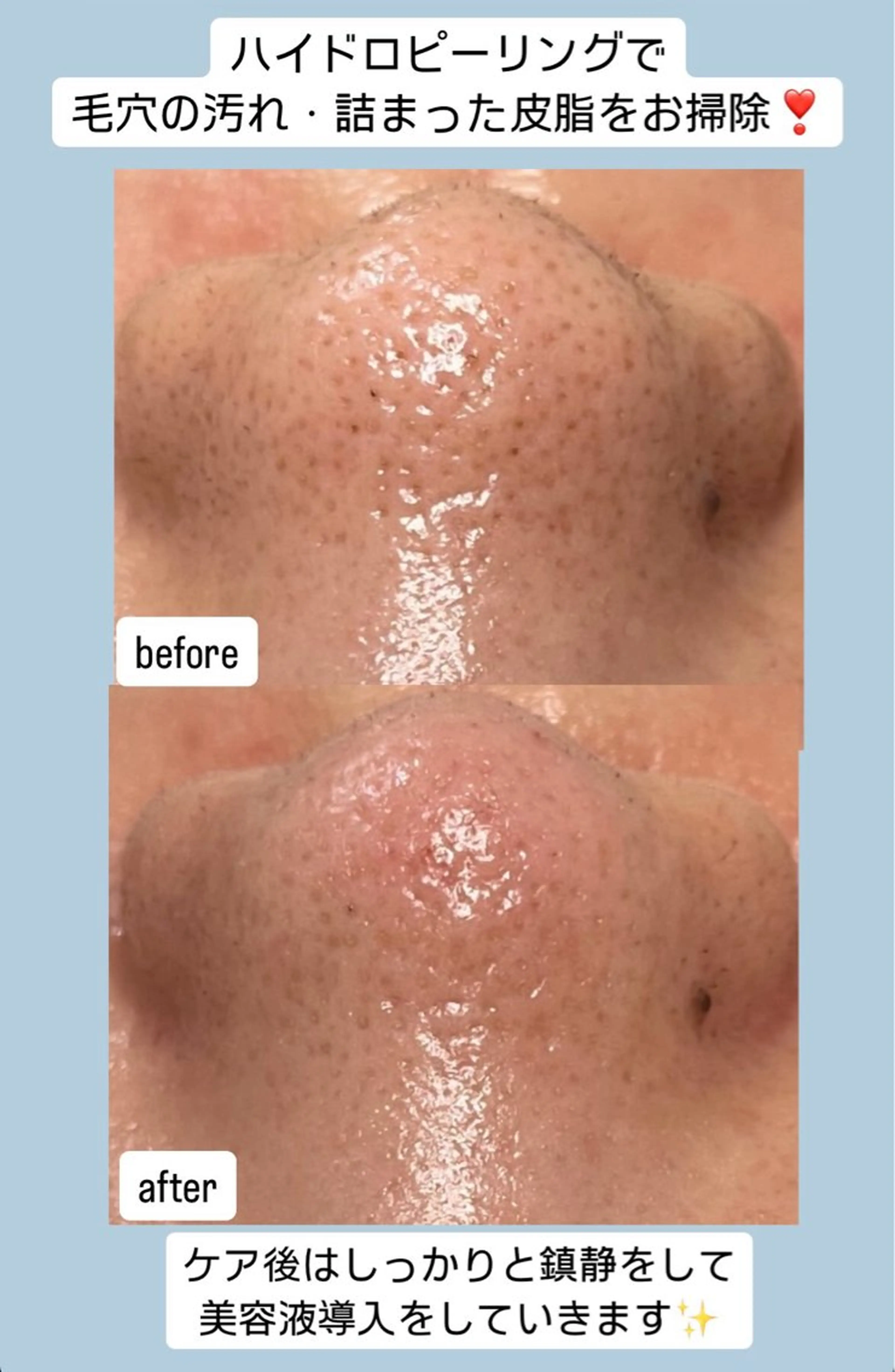 ベラージュ【美背中・ 美尻・フェイシャル】のエステ・リラクイメージ